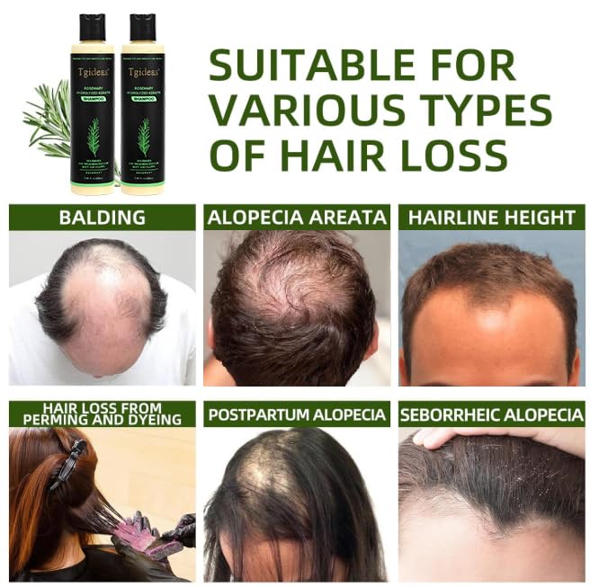 Detalle 2 de Tgideas Rosemary & Biotin Shampoo for Thinning Hair: Gentle Daily Care for Fuller, Stronger Strands