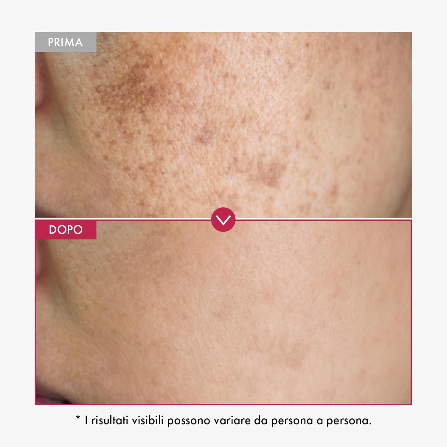 Detalle de TOSOWOONG Siero Viso con Niacinamide 10%, TXA 4% e Arbutina – Texture fresca, effetto uniforme