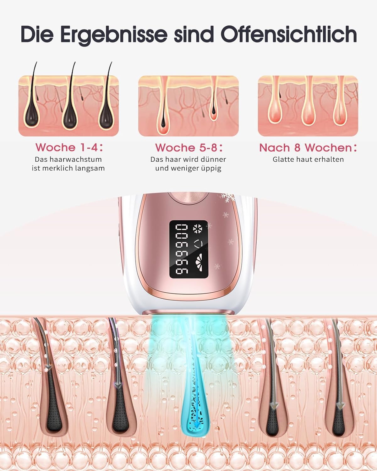 Thumbnail 4 de Haarlosy IPL Gerät – Haarentfernung mit Kühlfunktion TD005, 999.900 Lichtimpulse, 5 Energiestufen