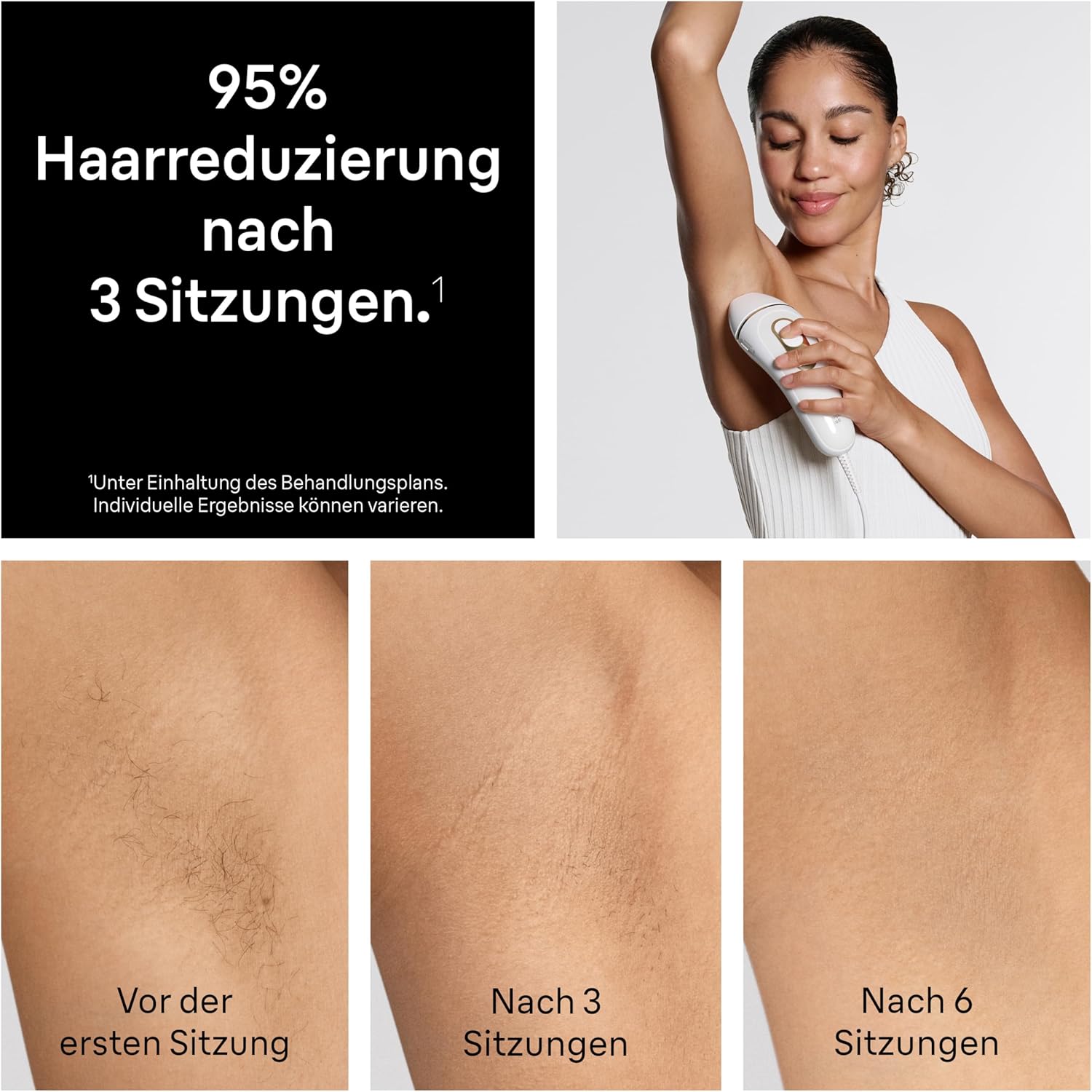 Detalle 2 de Braun Silk·expert Pro 5 IPL Haarentfernung