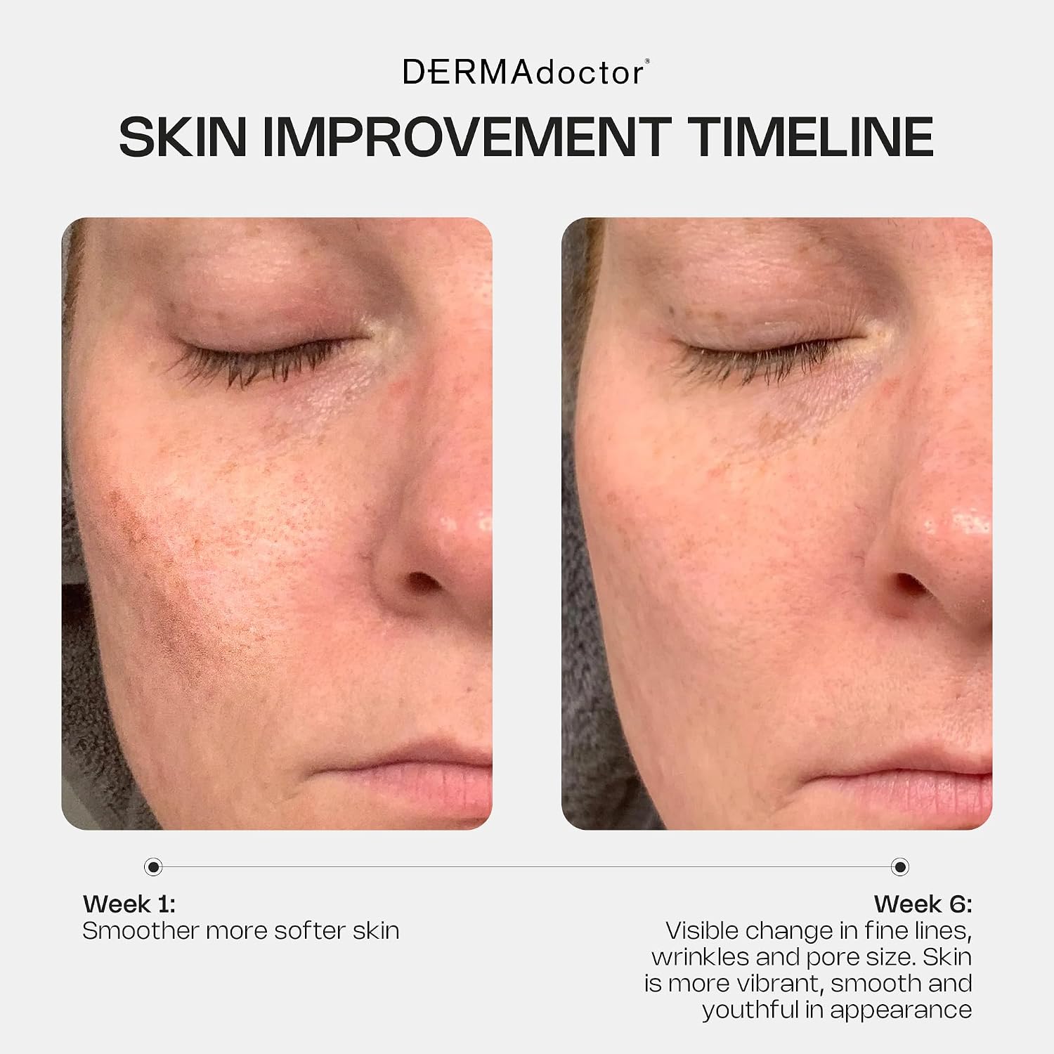 Detalle 2 de DERMAdoctor Kakadu C 1% Retinol y Antioxidantes Anti-Edad 🌟