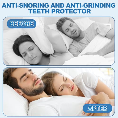 Thumbnail 4 de Nailpretty kit 4 piezas bruxismo dental Noche: protectores bucales termoplásticos anti-rechinar (2 tamaños)