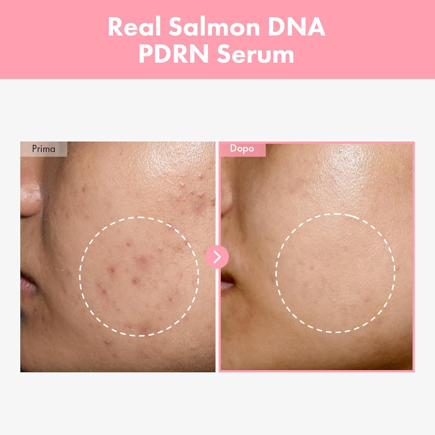 Detalle 2 de TOSOWOONG Siero Pink Peptide 33 ml 💧