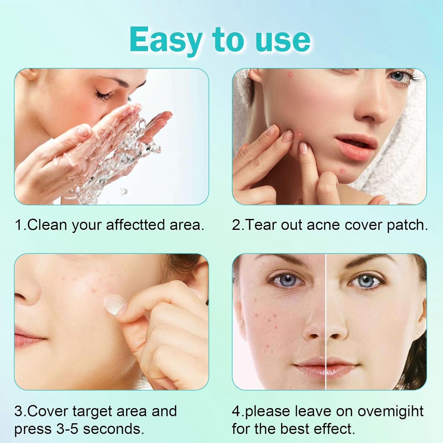 Thumbnail 2 de Pimple Patches Pickel Patch mit Teebaumöl & Salicylsäure – Anti-Pickel Pflaster (528 Stück)