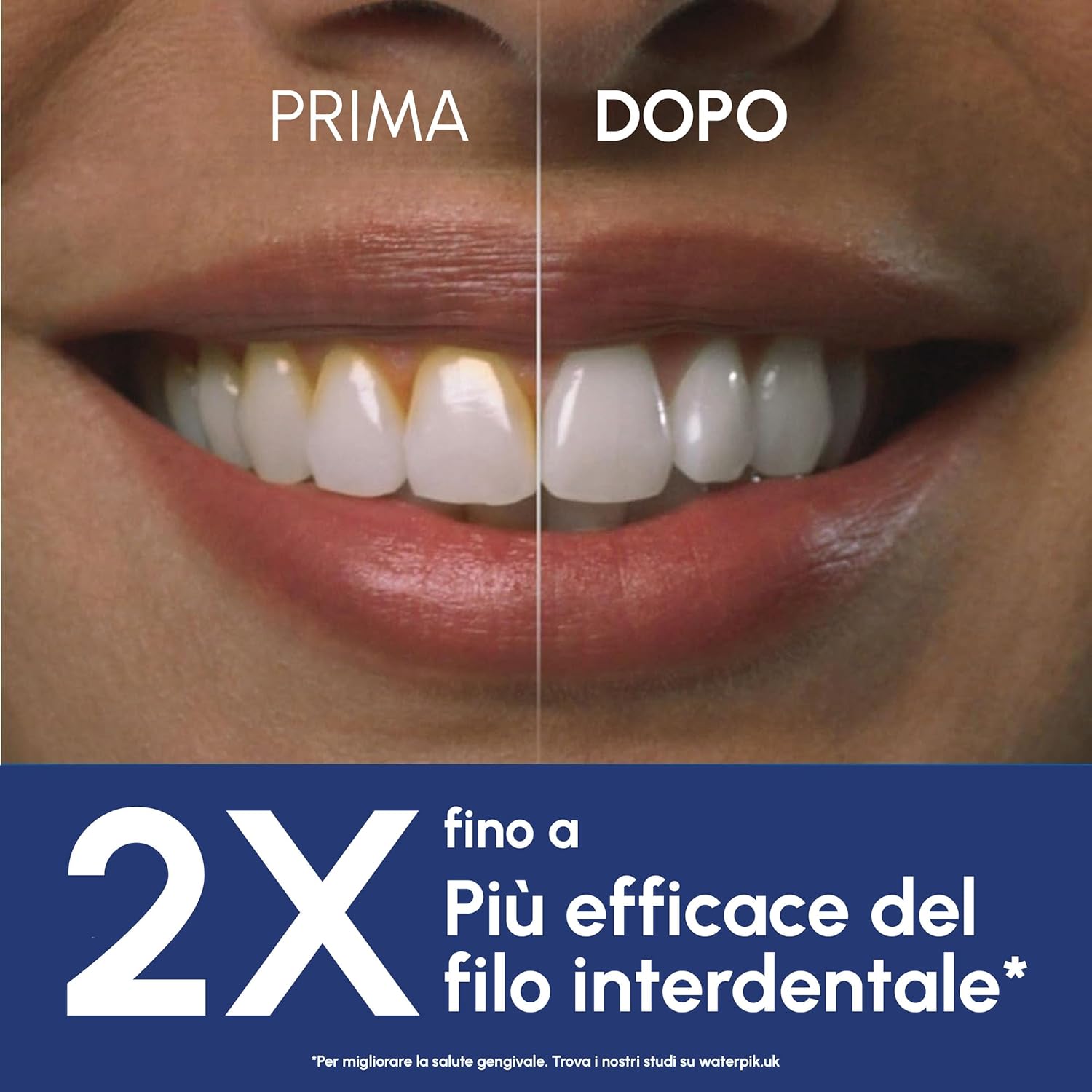 Thumbnail 2 de Waterpik Idropulsore Dentale Ultra Professional WP-662EU: 6 testine, 10 impostazioni di pressione, serbatoio 650 ml
