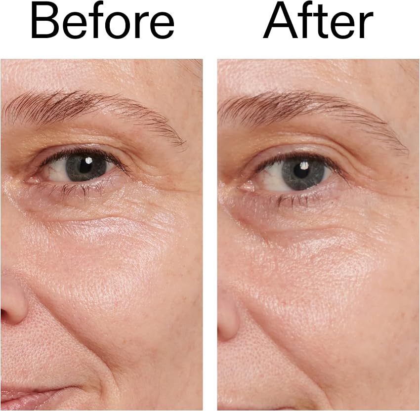 Thumbnail 4 de The INKEY List Retinol Eye Cream 15 ml