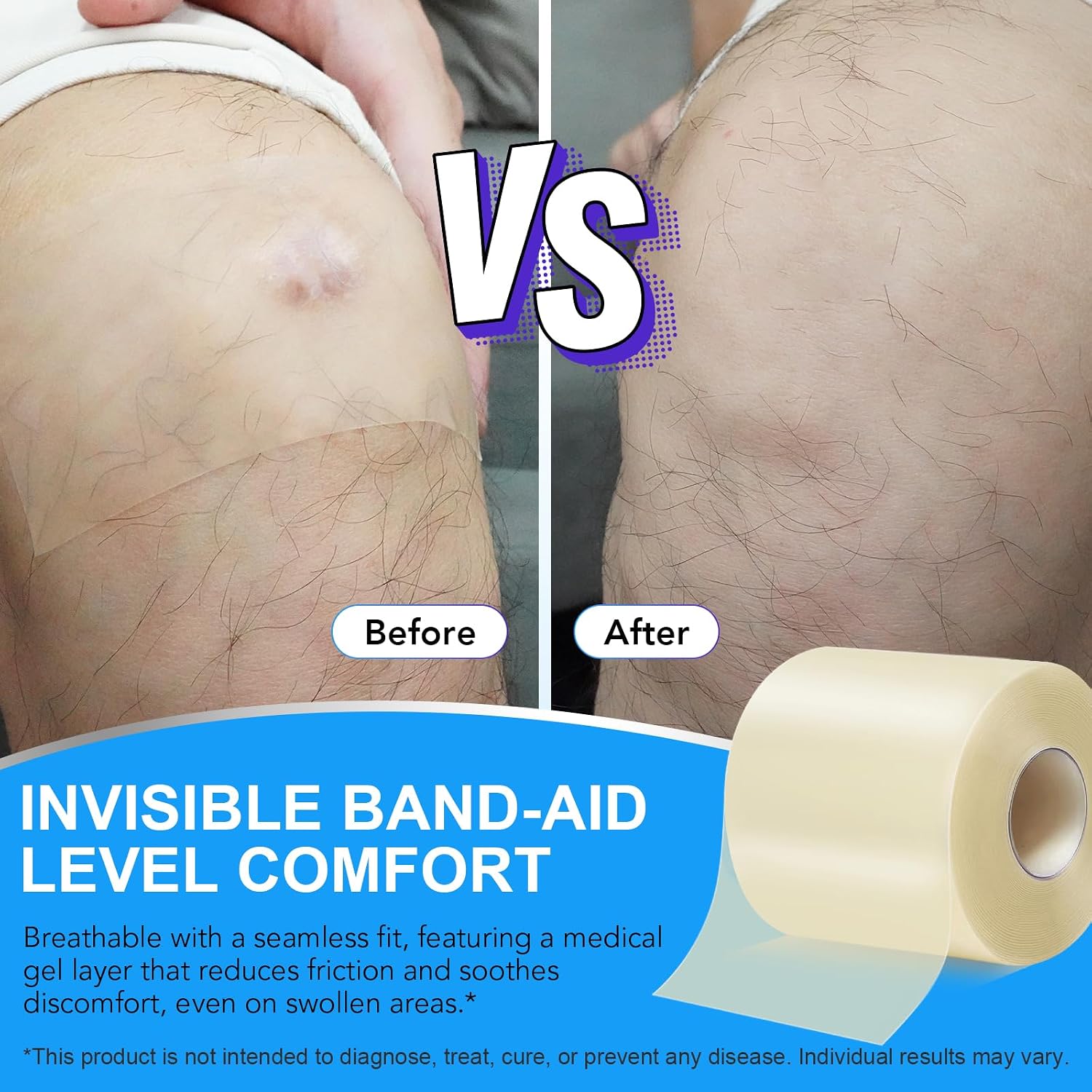 Detalle 1 de Feeliville hydrokolloidbandage på rulle, 5 cm x 5 m, självhäftande