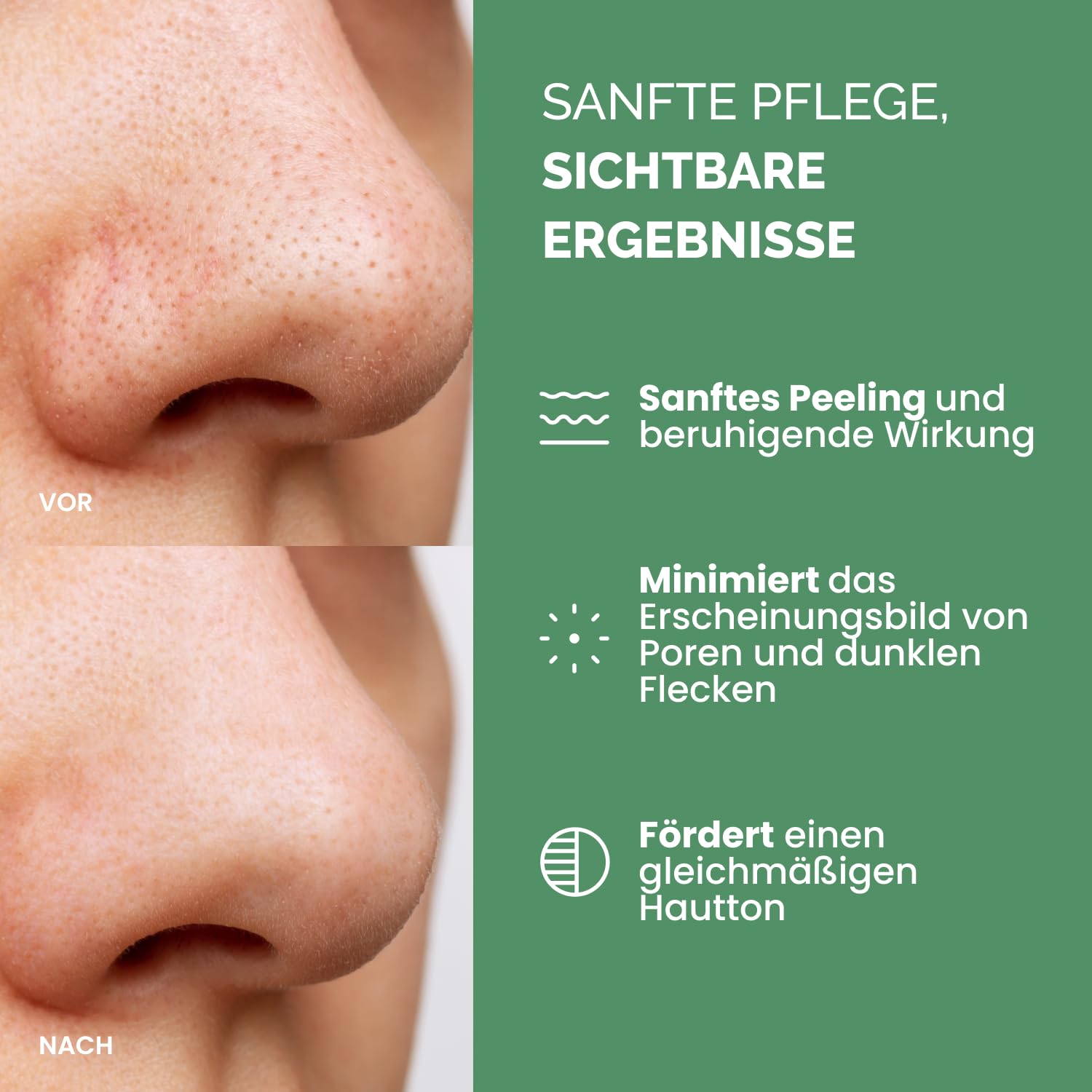 Detalle 2 de PLANTIFIQUE Korean Peeling Pads (60 Stück) mit Glycolsäure, Niacinamid, CICA & Multi-Acid-Komplex