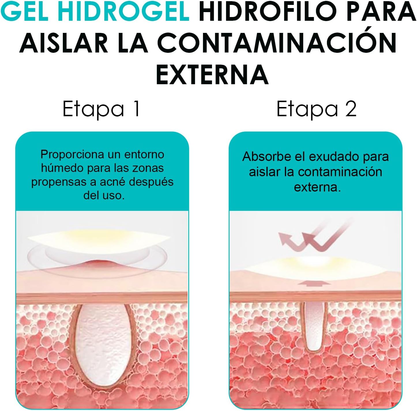 Detalle 2 de Parches para granos 264 piezas 5 tamaños