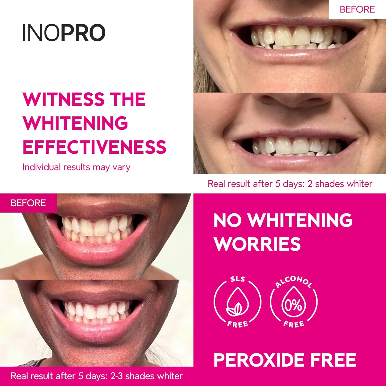 Thumbnail 2 de InoPro Teeth Whitening Strips 21 Treatments Kit – Non-Peroxide, Coconut Oil + Arbutin