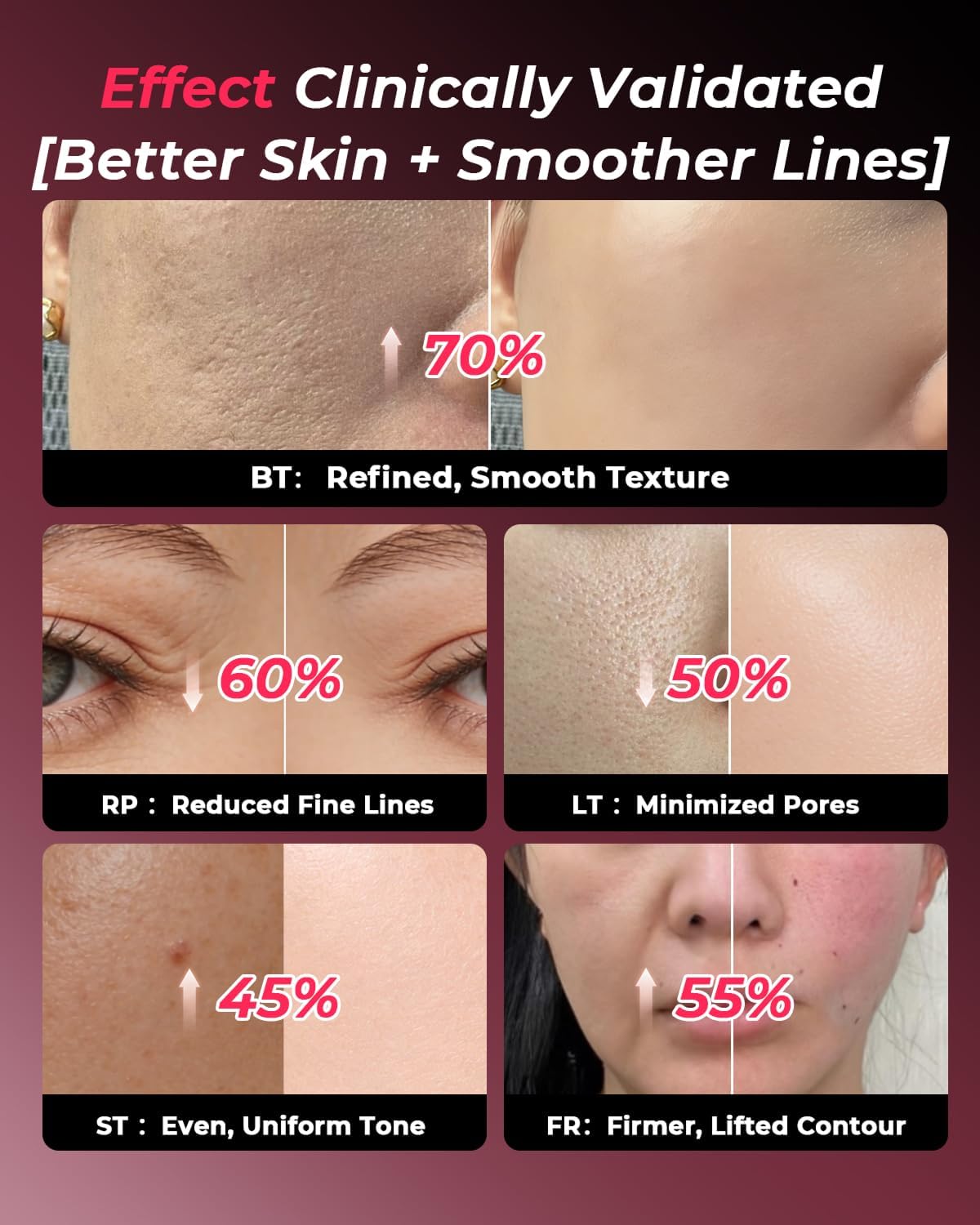 Detalle de Face Massager Facial Lifting Device — Electric Face Sculpting Tool with EMS Microcurrent Massage