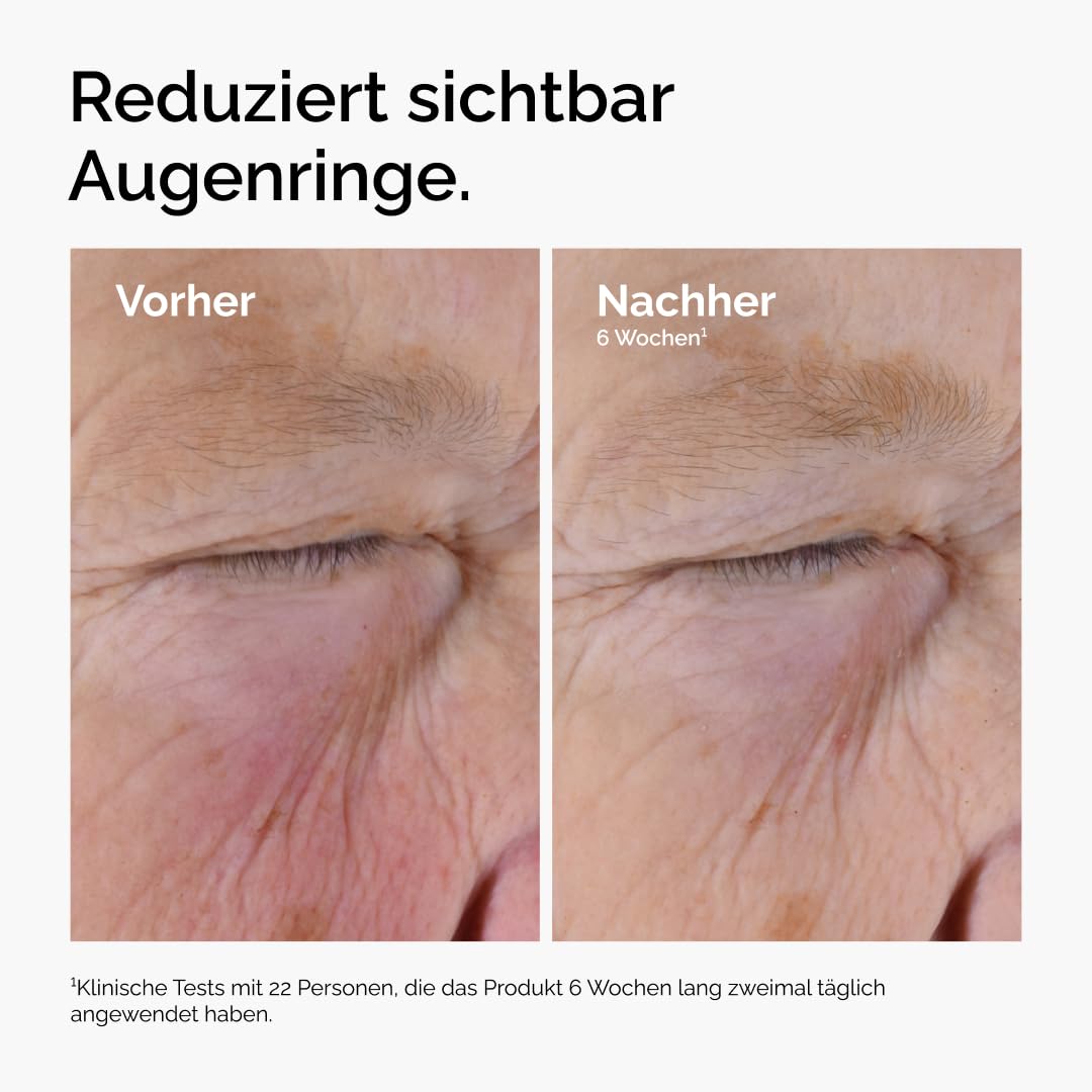 Detalle 2 de The Ordinary Caffeine Solution 5% + EGCG – Augenserum gegen Augenringe und müde Augen (30 ml)
