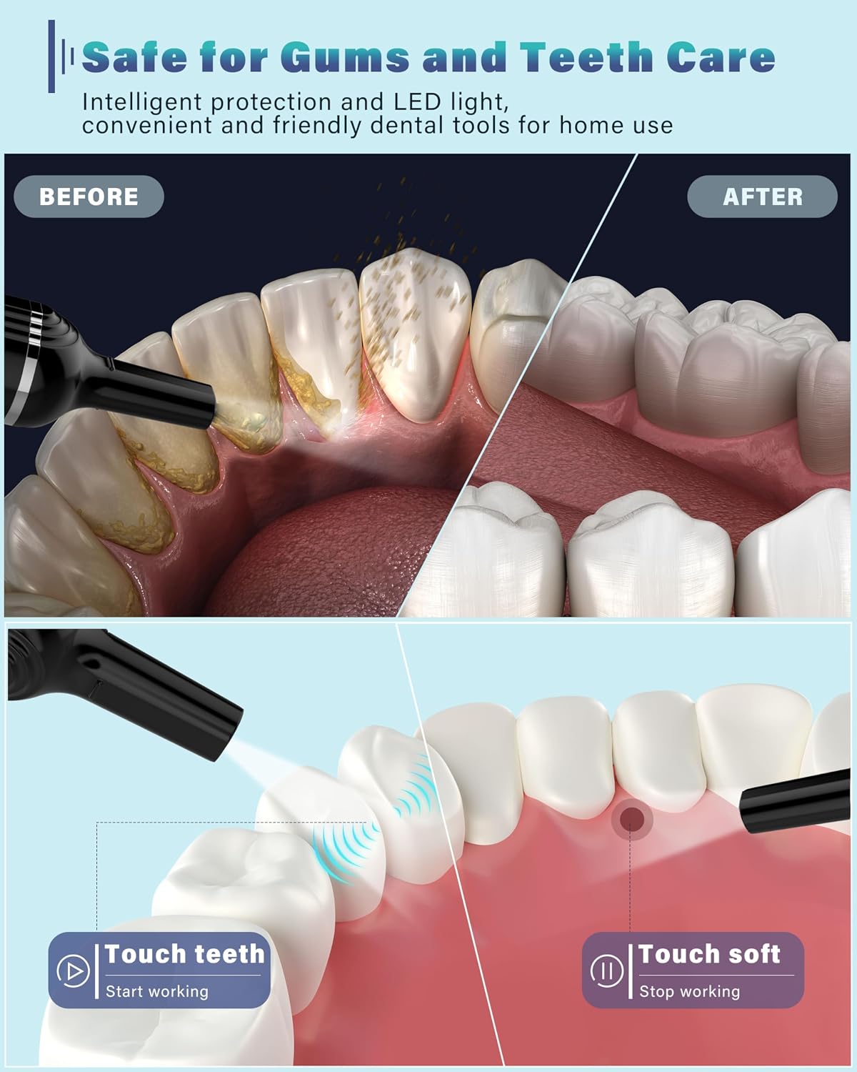 Thumbnail 2 de Wagner Stern Plaque Remover for Teeth