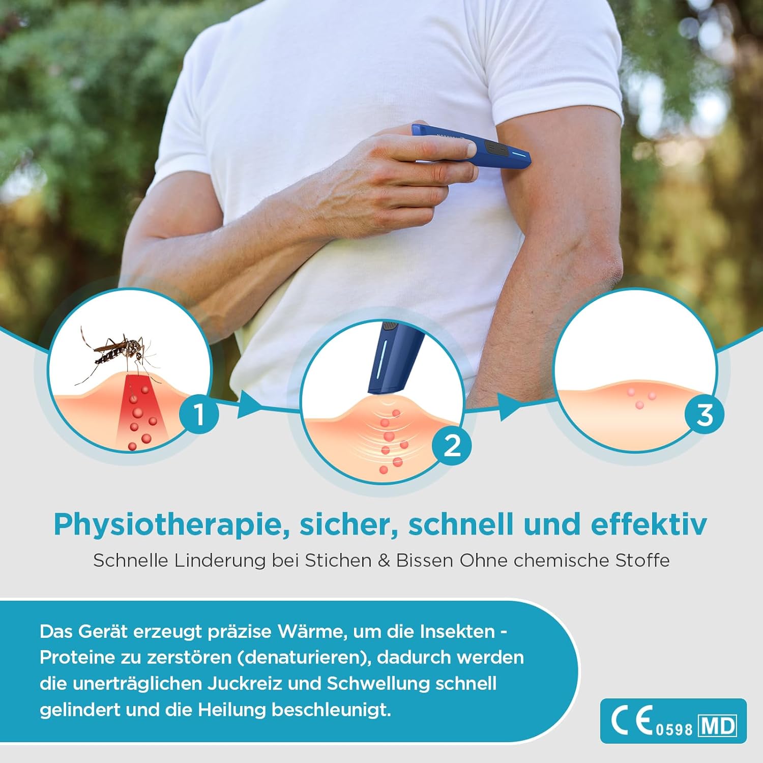 Detalle de MYCARBON Mückenstich Hitzestift – kompakter Stichheiler mit USB‑C, chemiefrei und schnell schmerzlindernd