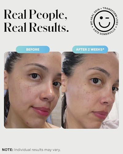 Thumbnail 4 de Kate Somerville EradiKate 3% Sulfur Daily Foaming Cleanser: Acne-Fighting Cleanser for Oily, Acne-Prone Skin