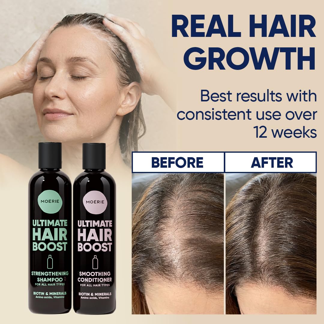 Thumbnail 2 de Moerie Hair Growth Shampoo and Conditioner Set (Biotin + Rosemary) for Thinning Hair