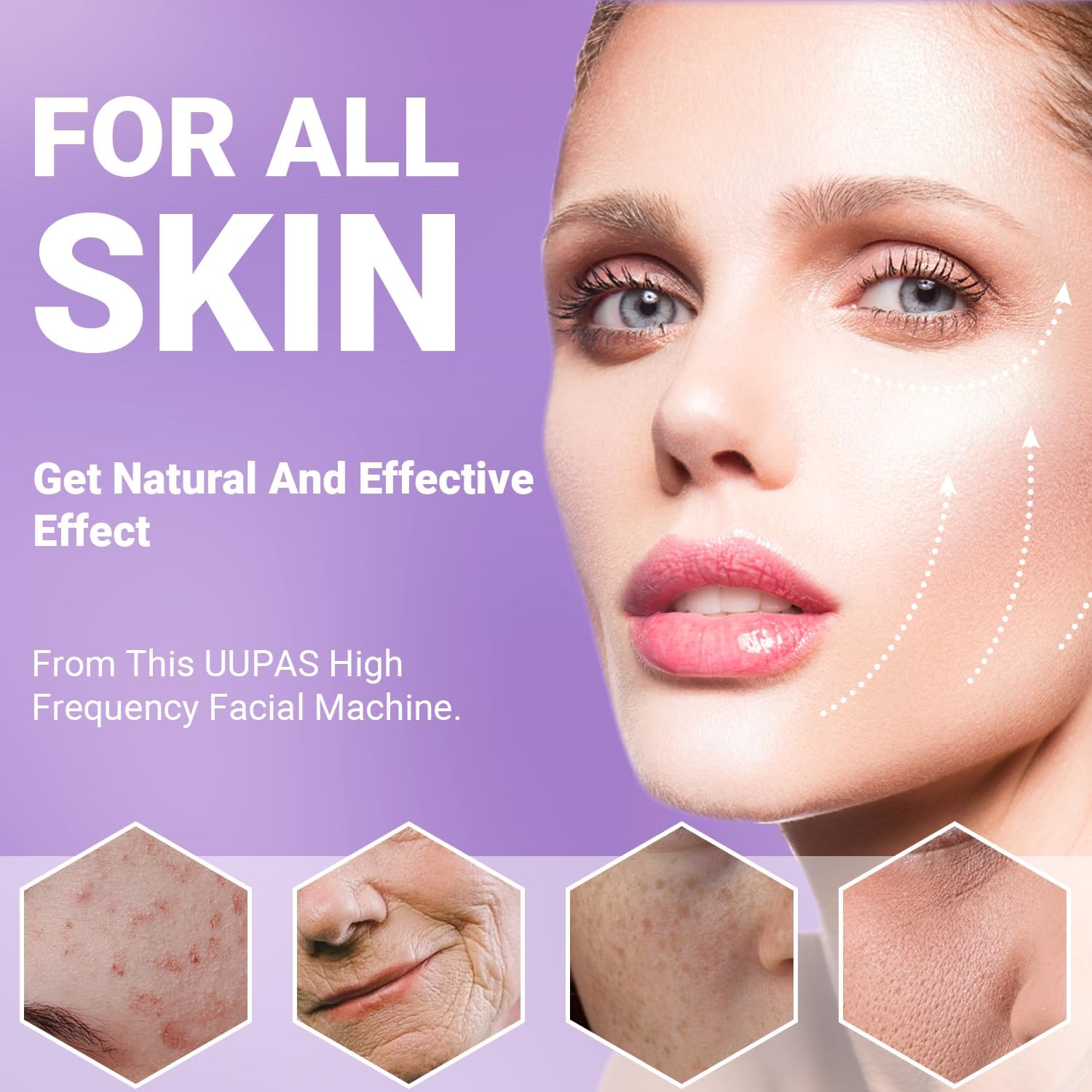 Thumbnail 2 de Bacchetta ad alta frequenza viso professionale UUPAS con 4 tubi ad argon