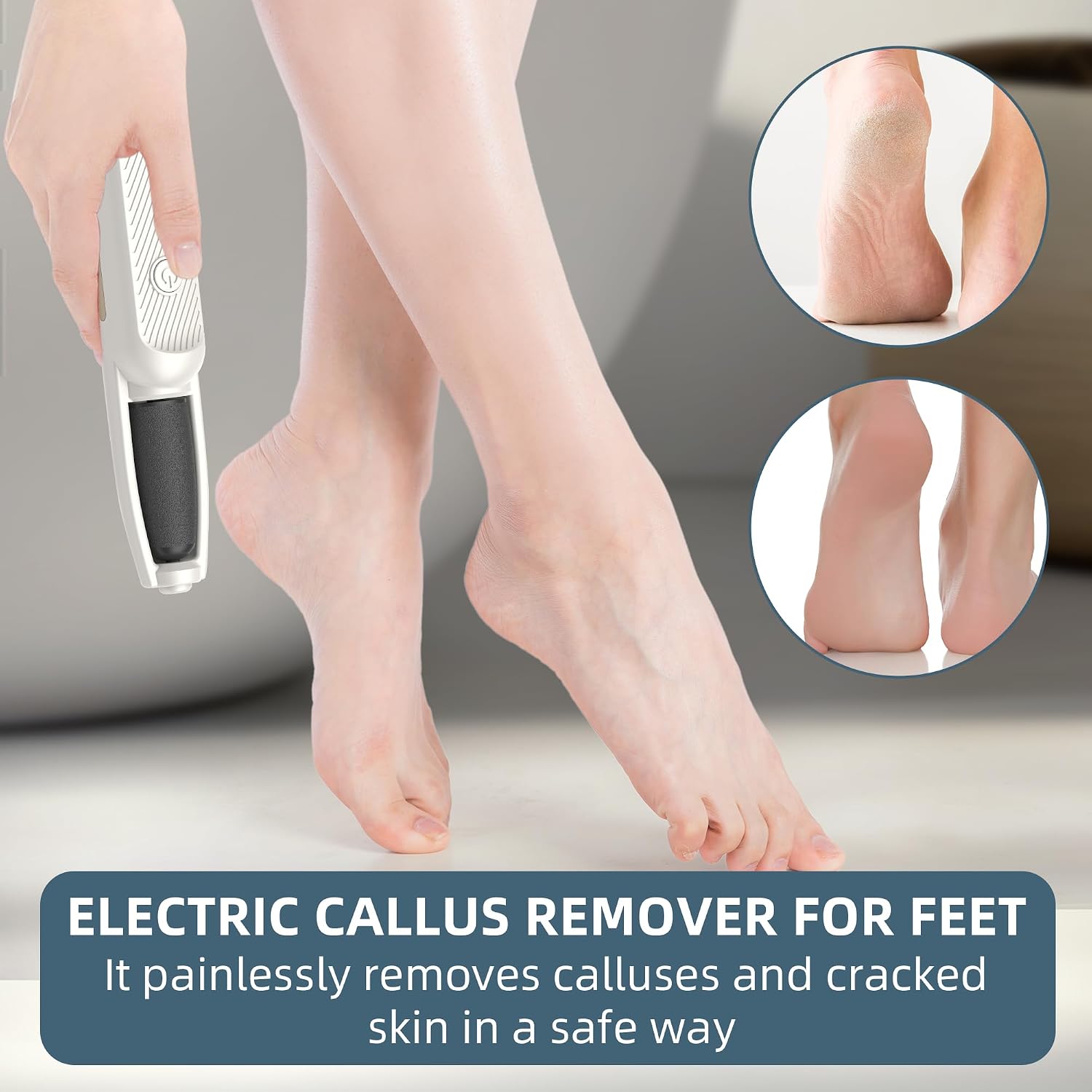 Detalle 2 de UQQU Electric Foot File rechargeable 1 device 🦶