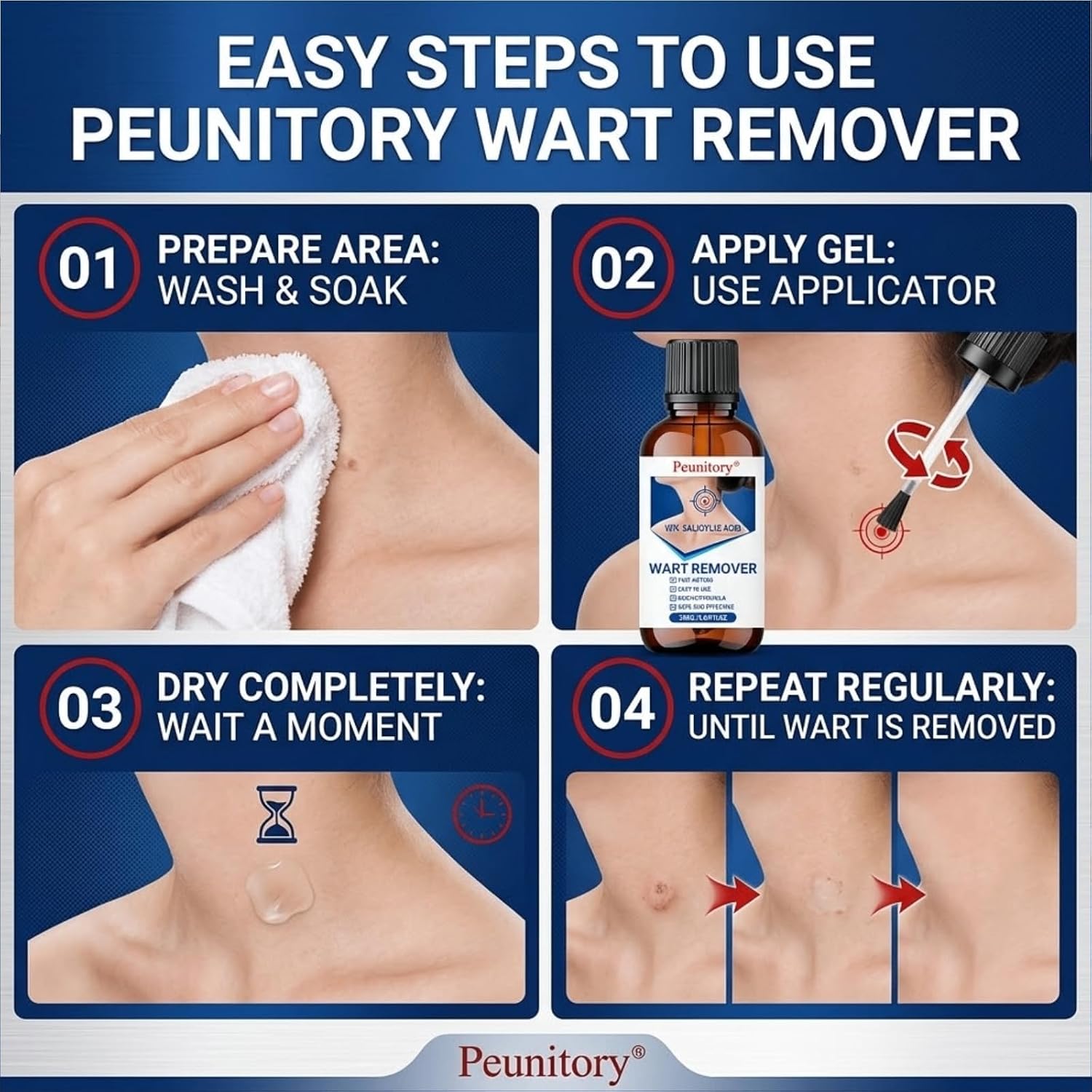 Detalle de Peunitory Wart Remover Liquid, 1.01 fl oz