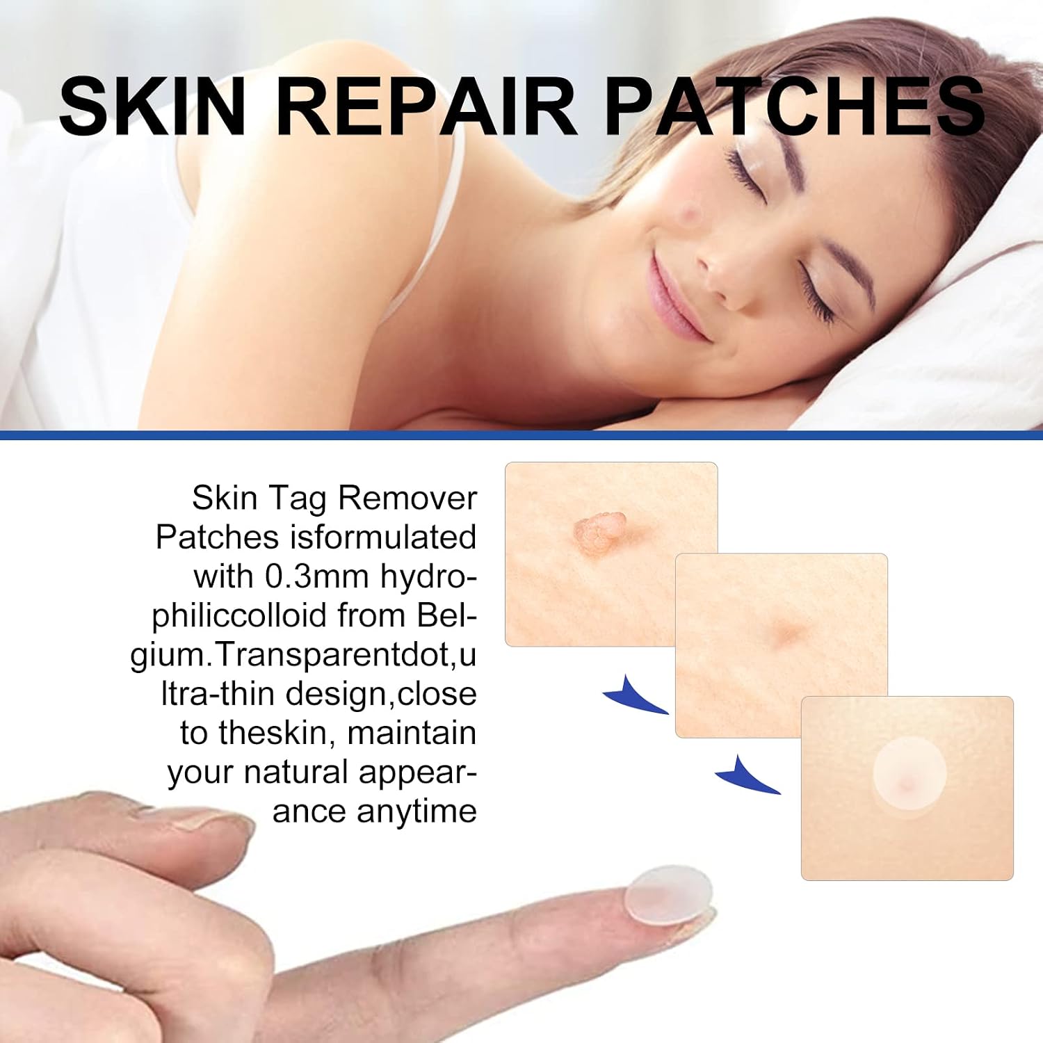 Thumbnail 5 de 2-in-1 Auto Skin Tag Removal Kit (Small to Large 1–9mm) — No Chemicals, No Burning
