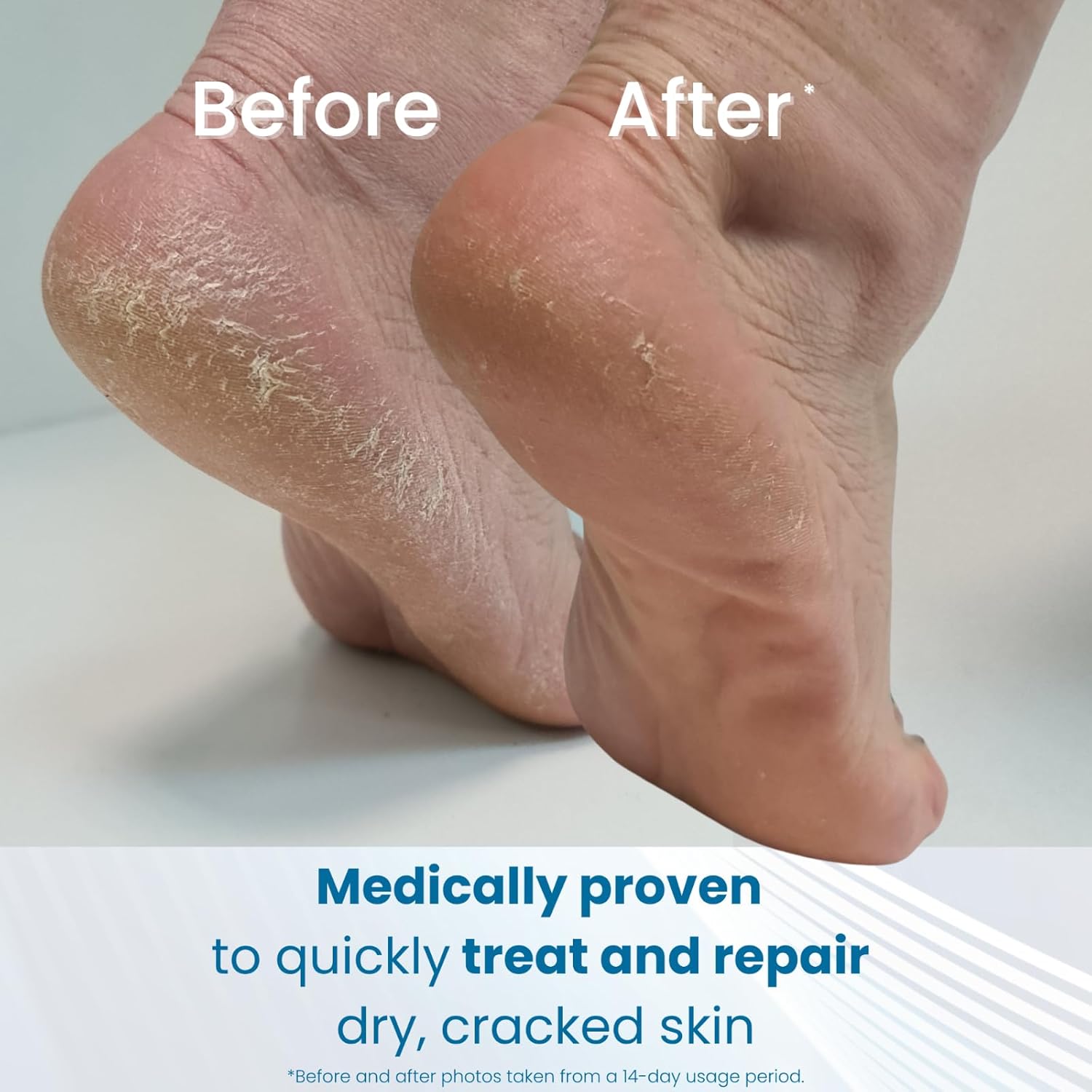 Detalle de Flexitol Cracked Heel Balm with 25% Urea — Visible Results in 1 Day