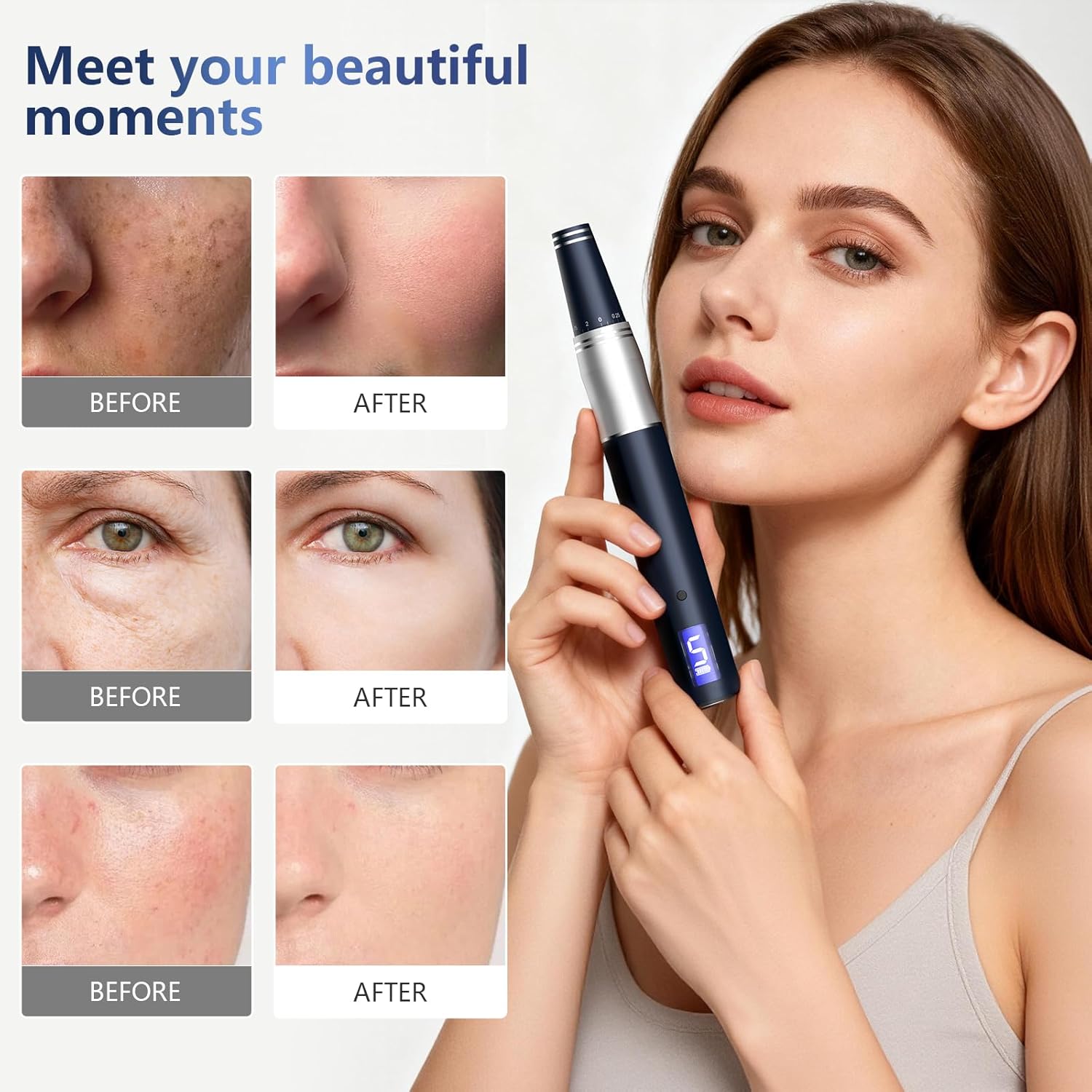 Thumbnail 6 de Microneedling Pen mit LCD-Display – Dermapen-Set mit 24 Einweg-Nadeln und 5 Geschwindigkeitsstufen