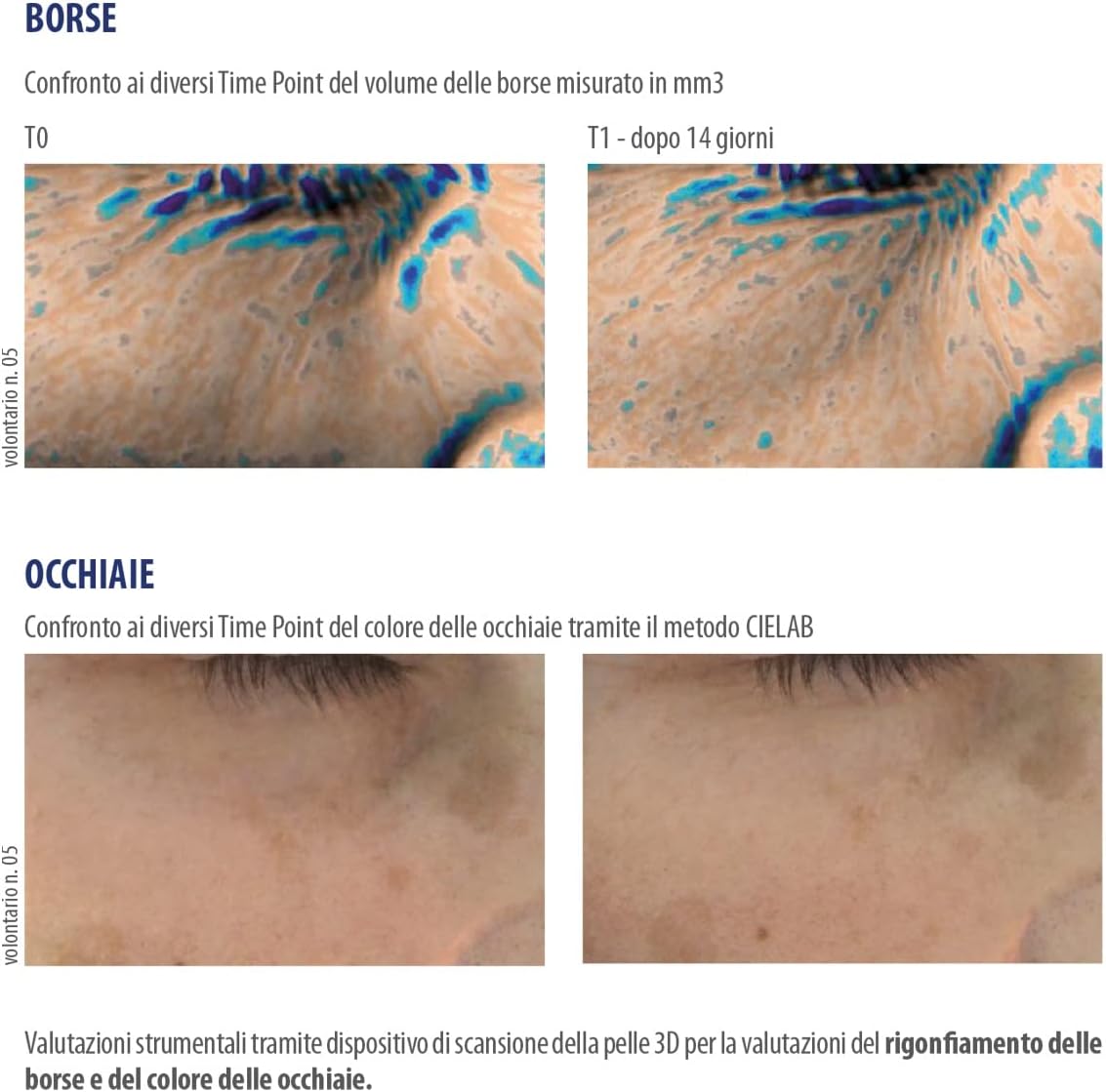 Detalle de Helan IREOS Contorno Occhi Occhiaie Effetto Lift – Siero Gel Roll-On 10 ml