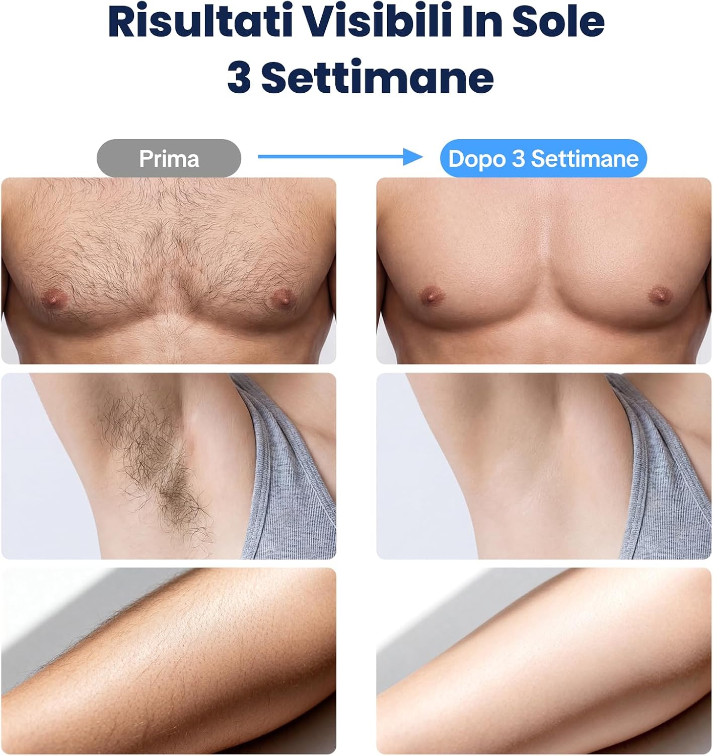 Thumbnail 6 de MANKIW IPL Epilazione con Raffreddamento – 5 livelli, 500.000 impulsi, uso automatico/manuale