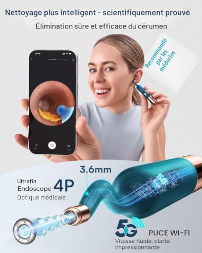 Detalle de Bebird Earsight Ultra Détartrant pour Oreilles avec 5G-WLAN et Otoscope HD 1080P – kit complet