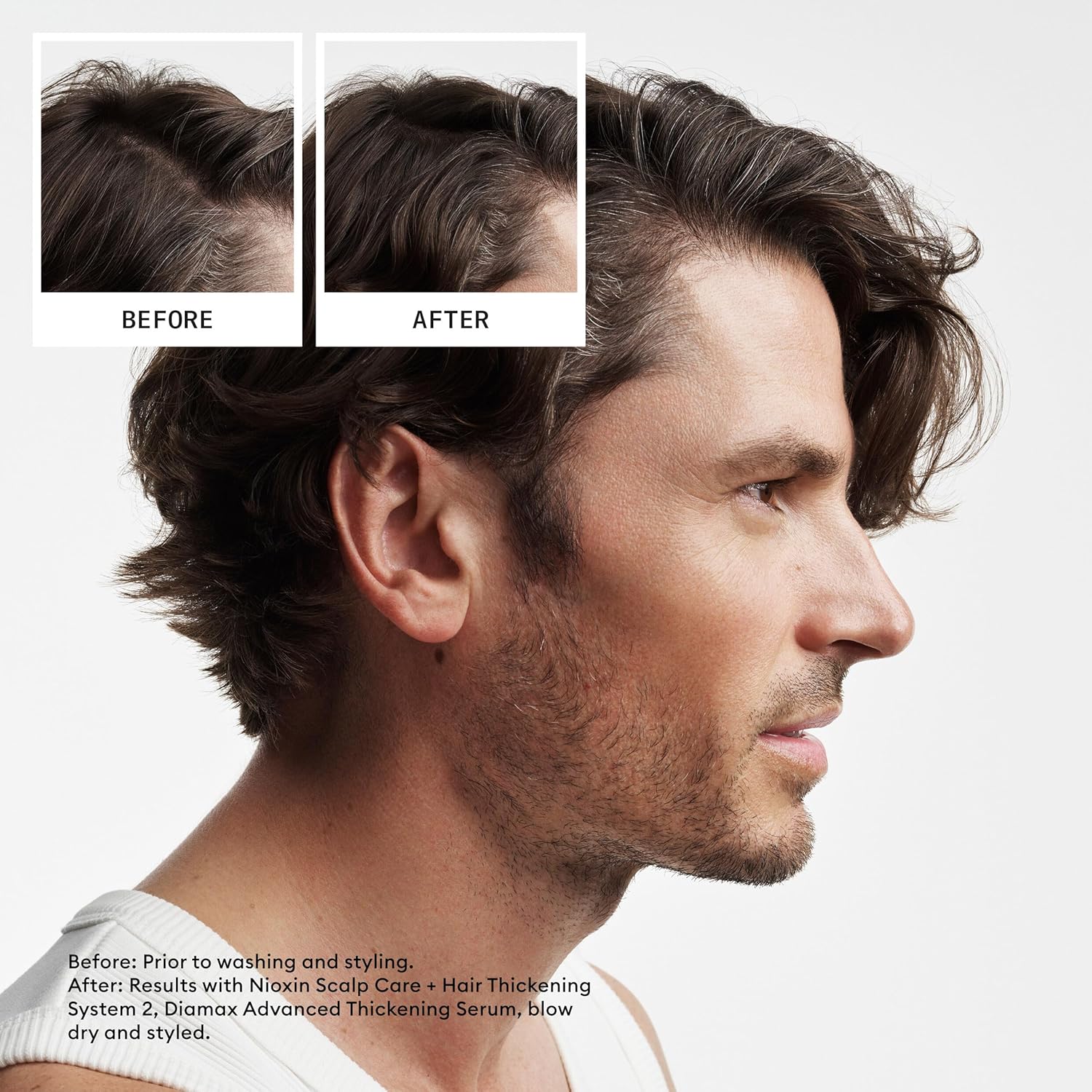 Thumbnail 4 de Nioxin System 2 Hair Thickening System for progressed thinning (biotin & niacinamide) – Shampoo, Conditioner & Scalp Serum