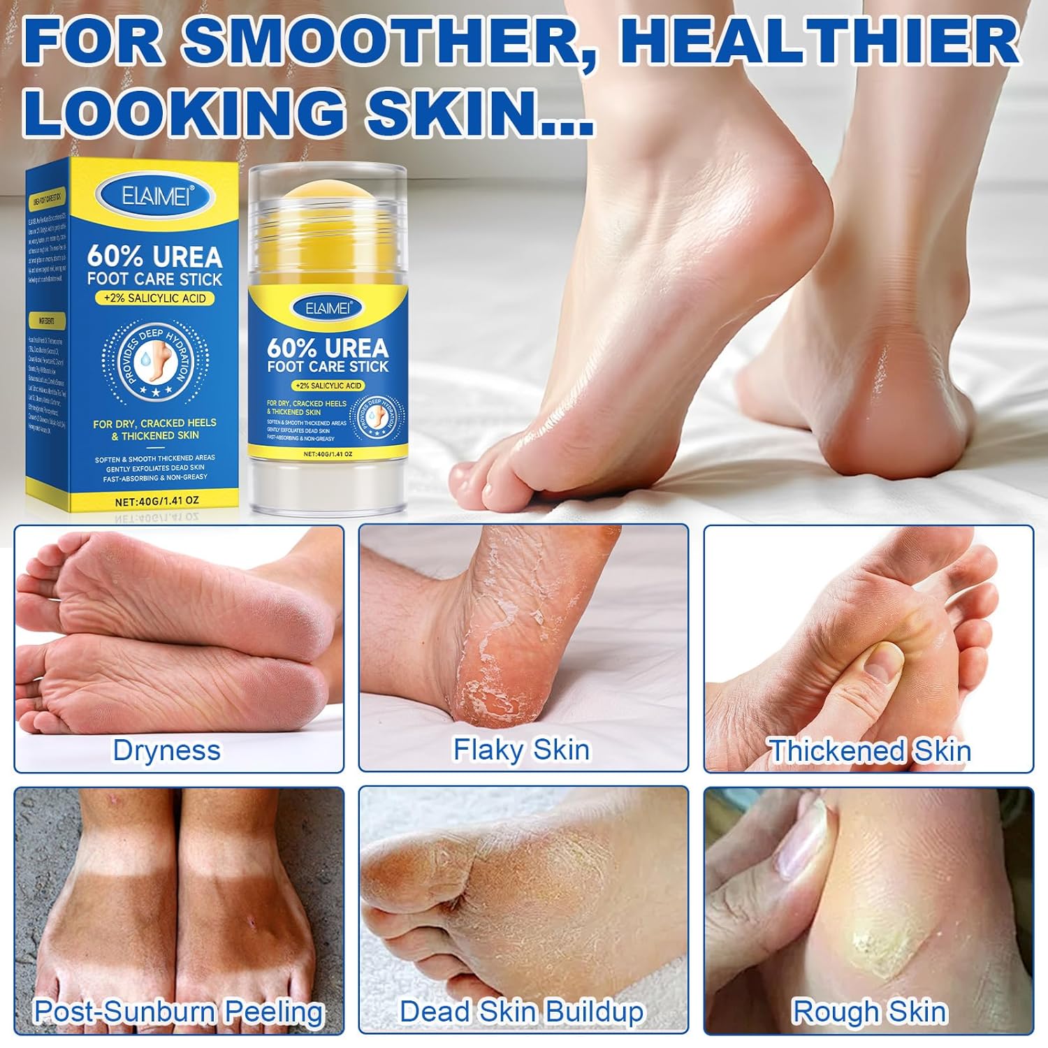 Thumbnail 4 de Urea Cream 60 % für Füße (60 % Harnstoff) Stick mit 2 % Salicylsäure, 40 g – für rissige Fersen