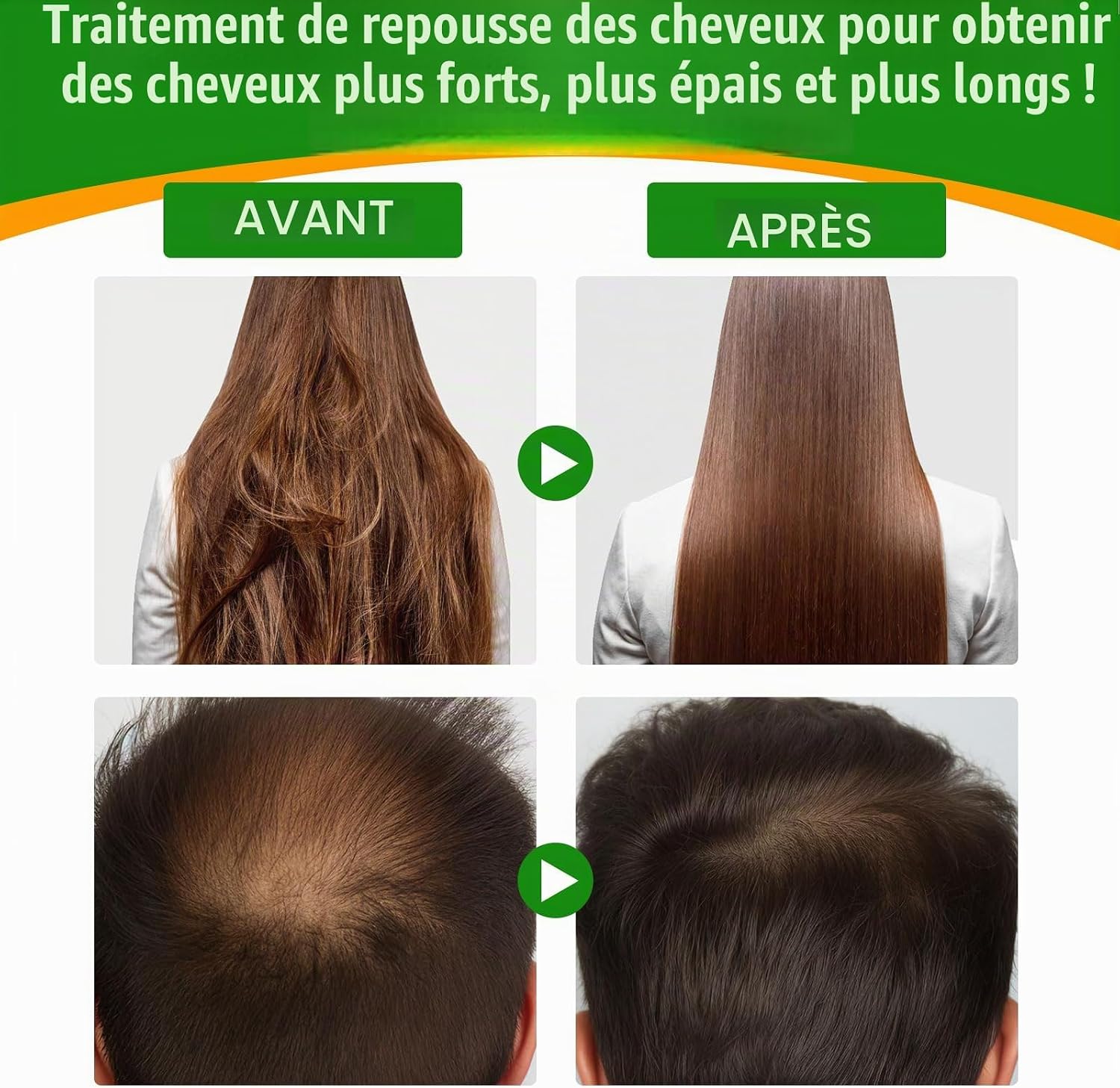Detalle 2 de AIKUWWOIRQIA Batana-olie 60 ml voor haar, hoofdhuid en huid