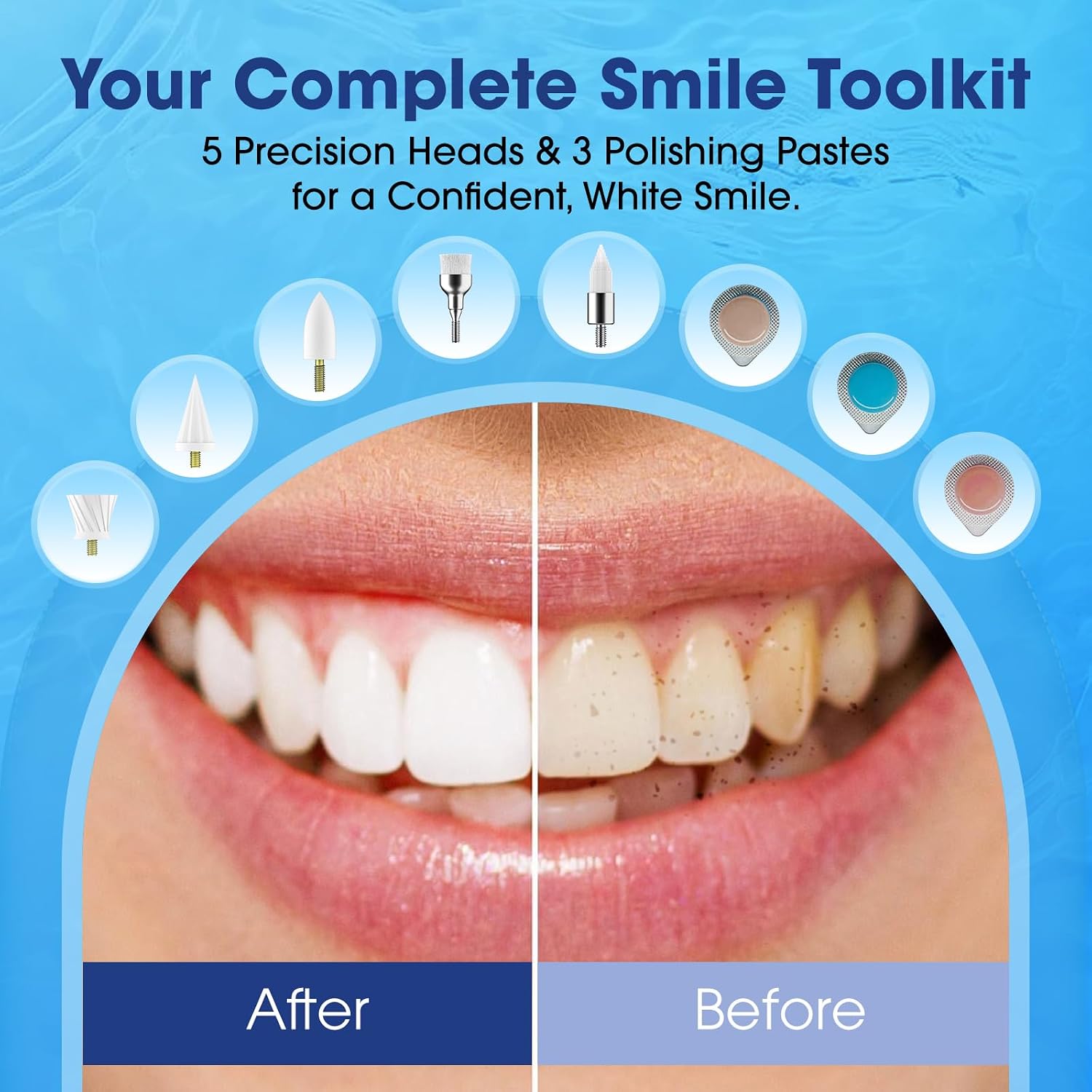 Thumbnail 3 de InFanso Tooth Polisher Plaque Remover for Teeth: A Practical Whitening Kit with 5 Modes