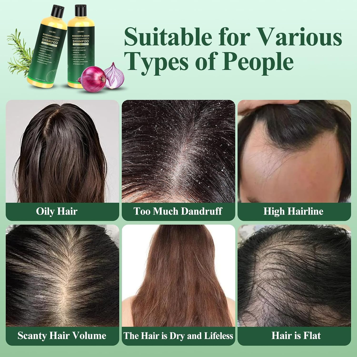 Detalle de Shampoo Rosemary & Cipolla 500ML: rinforza, équilibre e morbidezza quotidiana