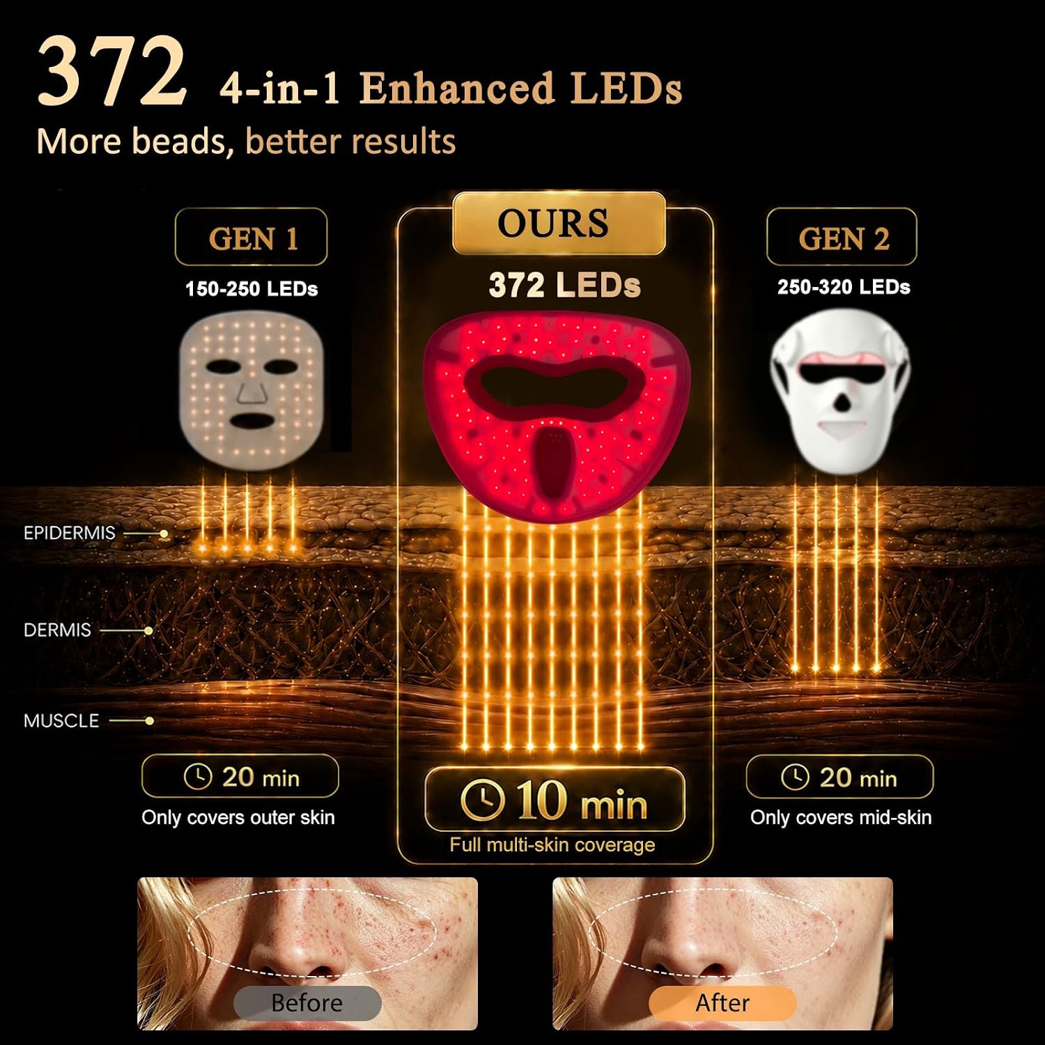 Detalle de REEZO Red Light Therapy Mask 4D