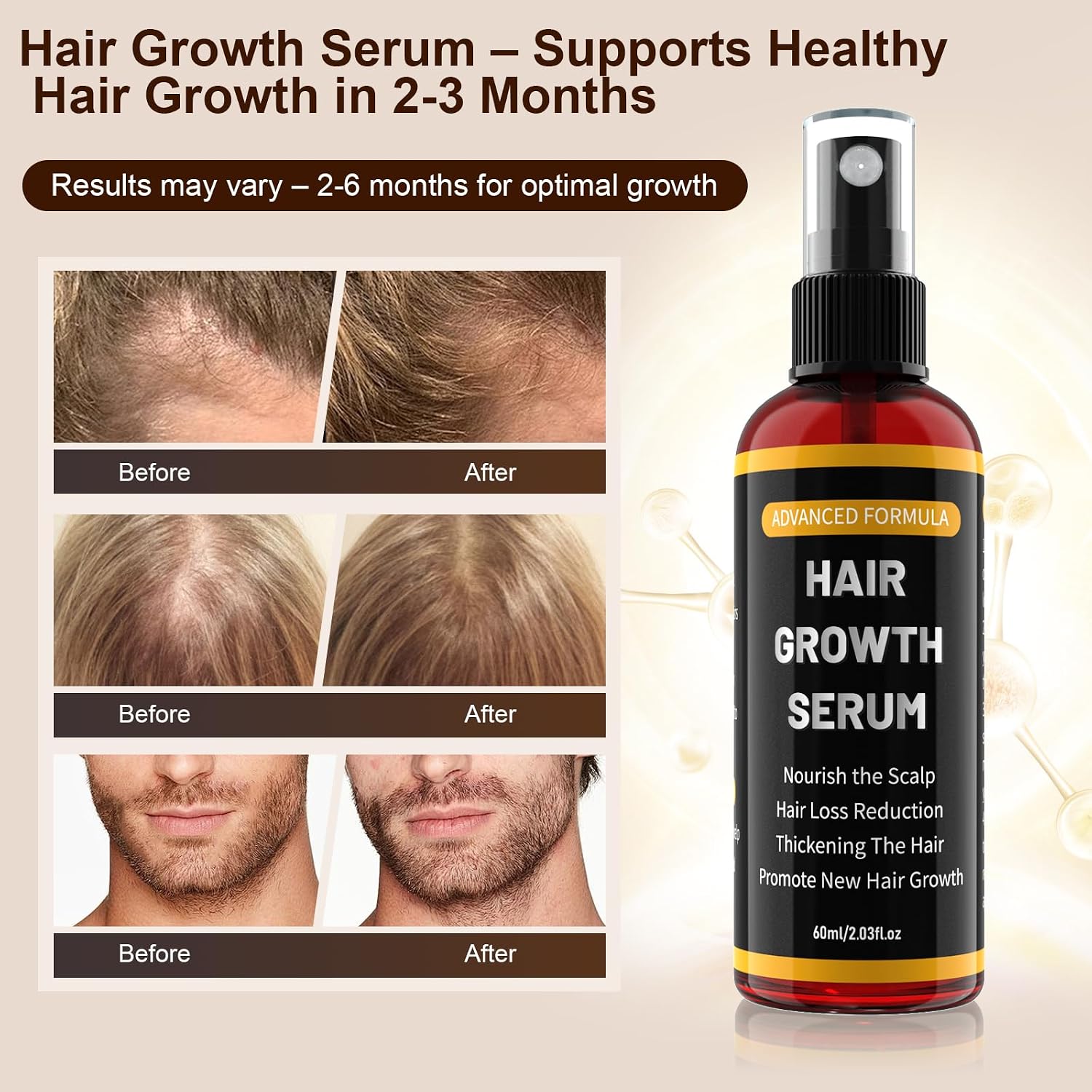 Detalle de Spray Siero Crescita Capelli 3×60 ml: olio di rosmarino, ricino e biotina per uomo e donna