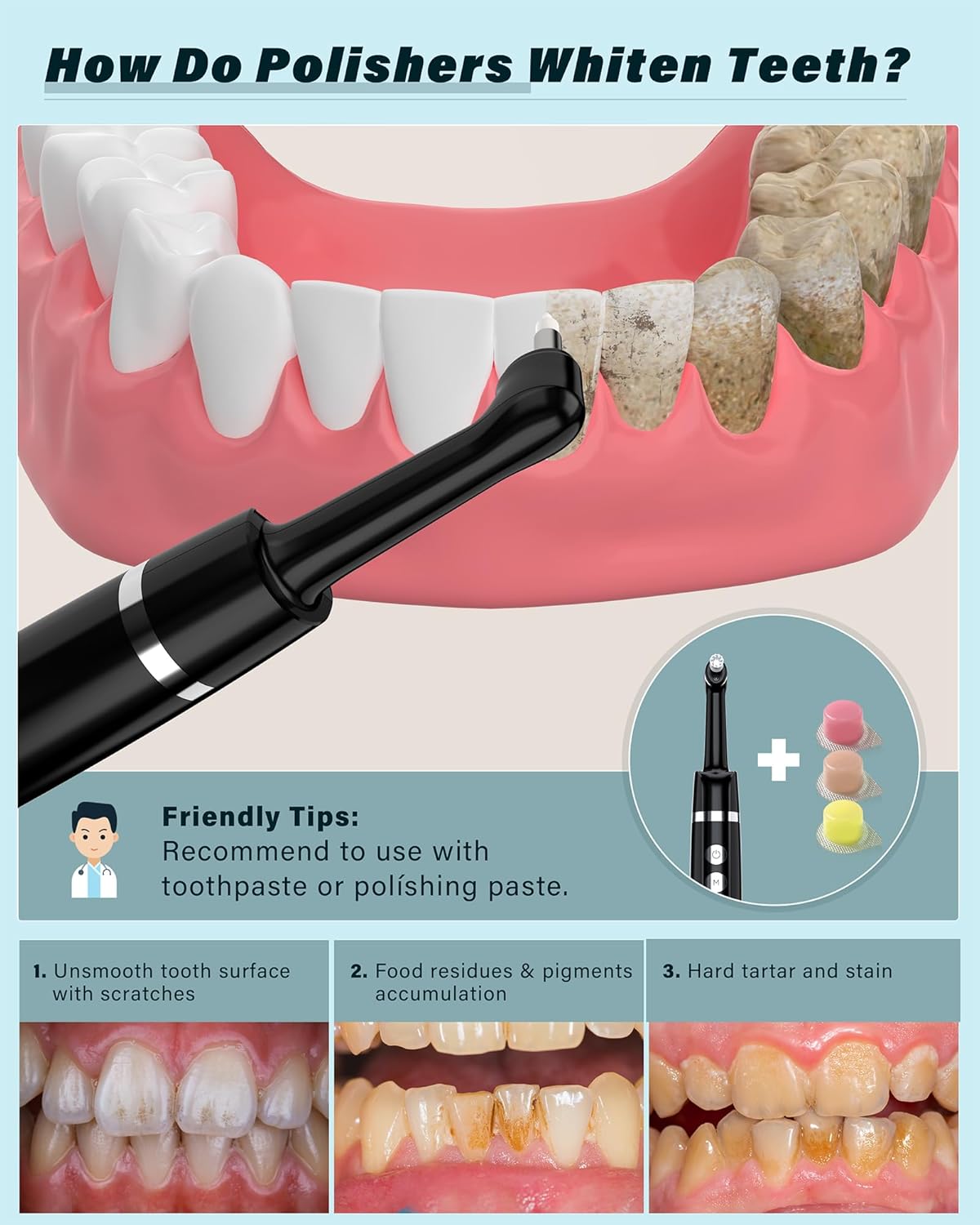 Thumbnail 1 de Tooth Polisher: Rechargeable Tooth Whitening Kit with 5 Brush Heads and LED Light