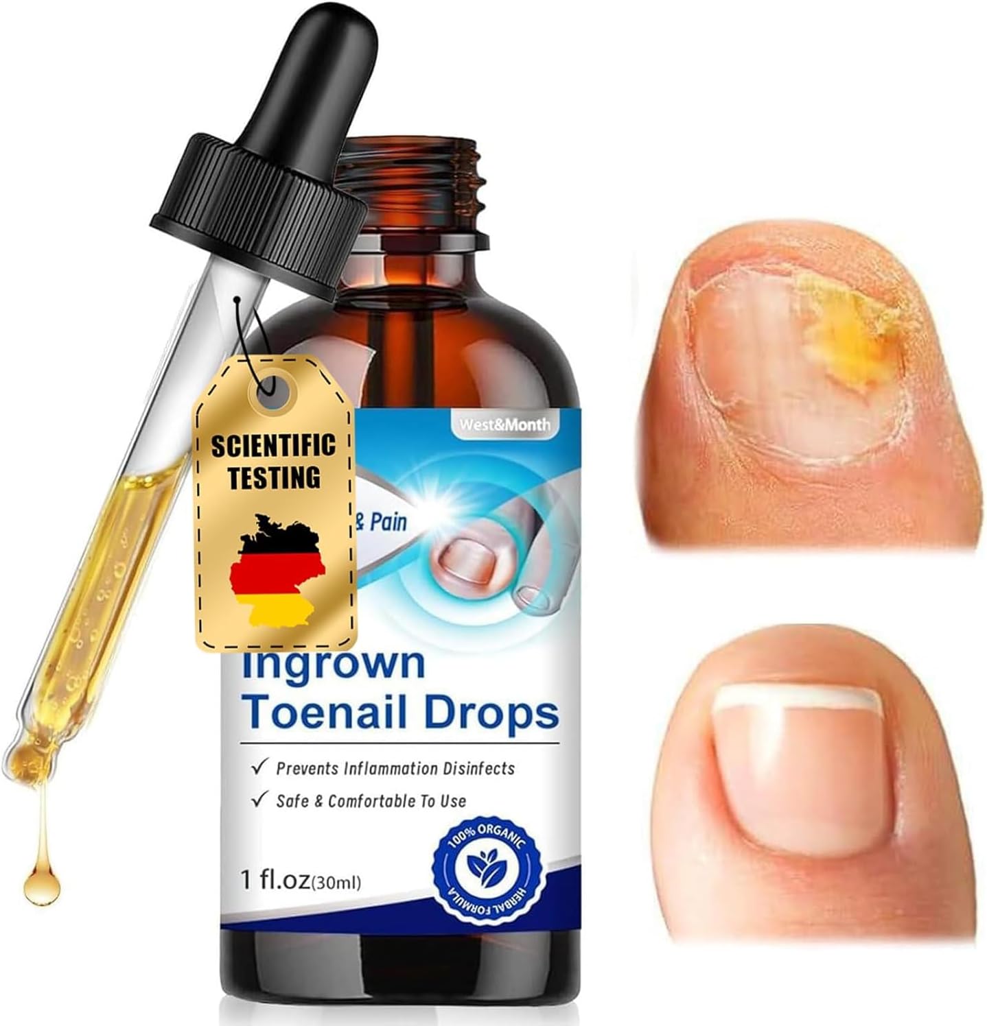 Liquido riparatore per unghie piedi 30 ml: olio/cura con contagocce per unghie incarnite