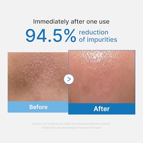 Detalle de medicube Cleansing Oil Zero Pore Blackhead Huile Nettoyante – Nettoie et dissout maquillage et impuretés en douceur