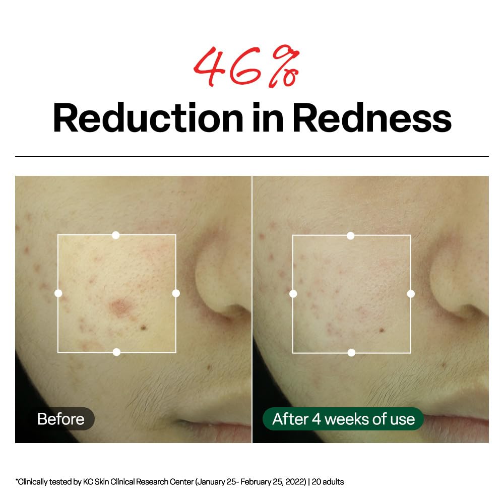 Thumbnail 3 de Dr. G R.E.D. Blemish Clear Soothing Cream – Calming Korean Moisturizer for Redness