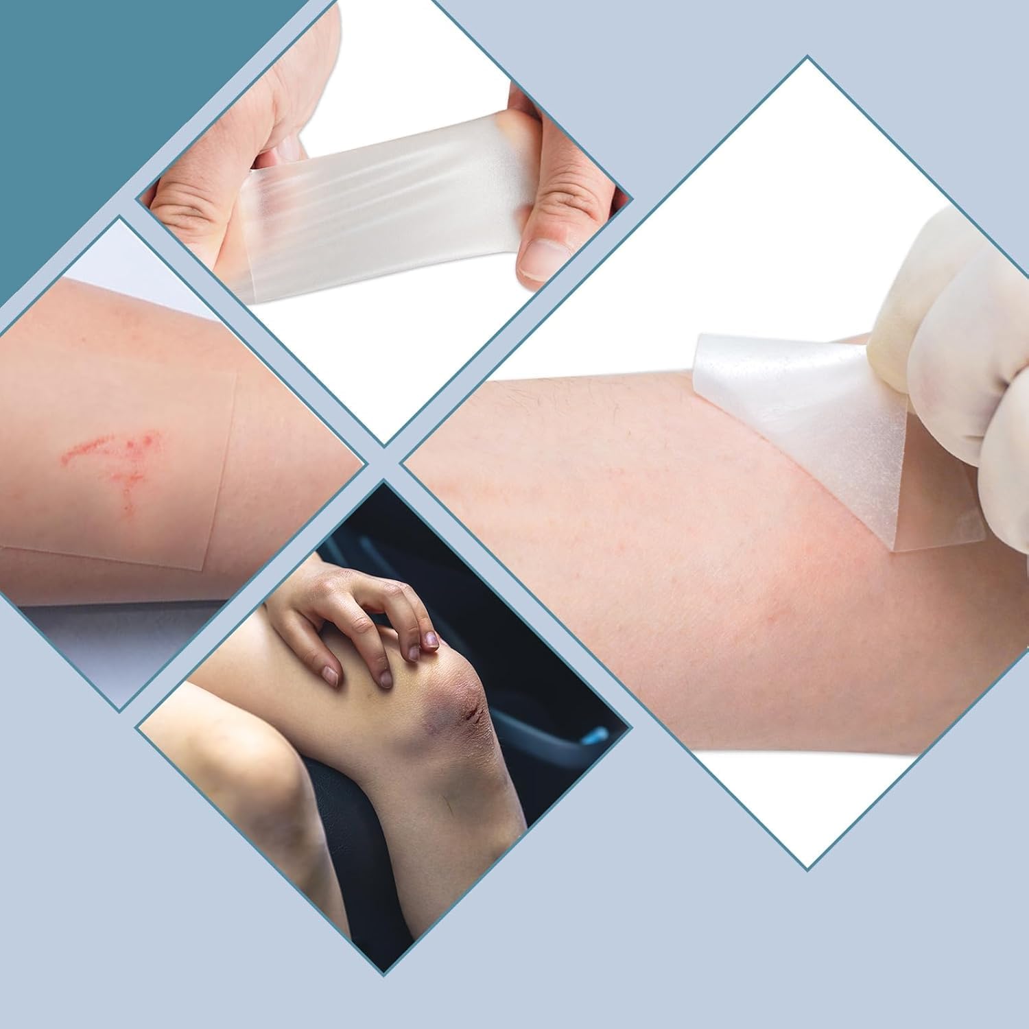 Detalle de Rayyl Hydrocolloid Roll 5cm x 1.5M – Ultra-Thin 0.3mm Self-Adhesive Patches for Blisters, Cuts & Minor Skin Irritations