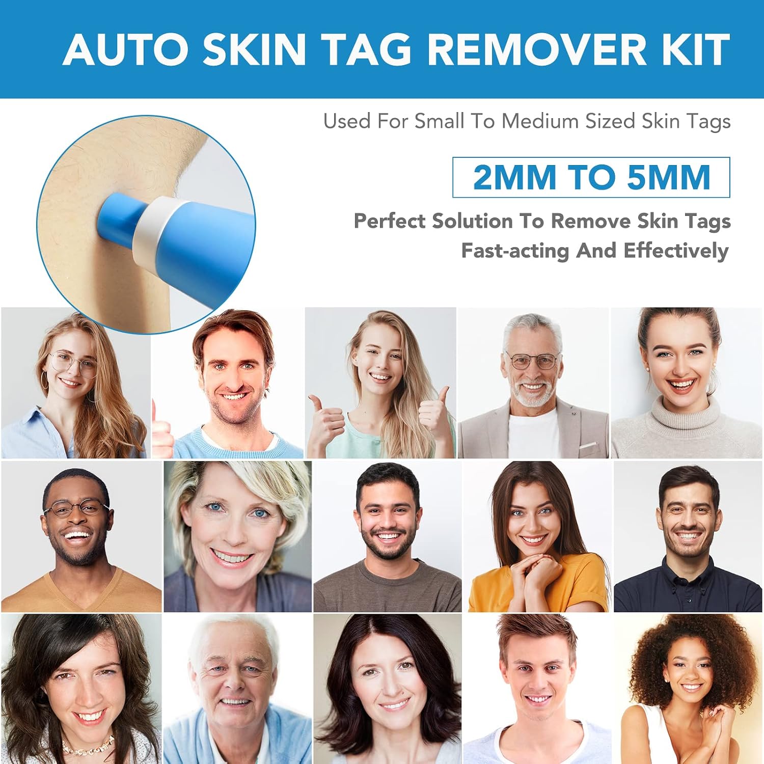 Thumbnail 5 de Skin Tag Removal Kit with 40 Bands (2mm-8mm) – Comfort Fit Elastic Bands for Home Use