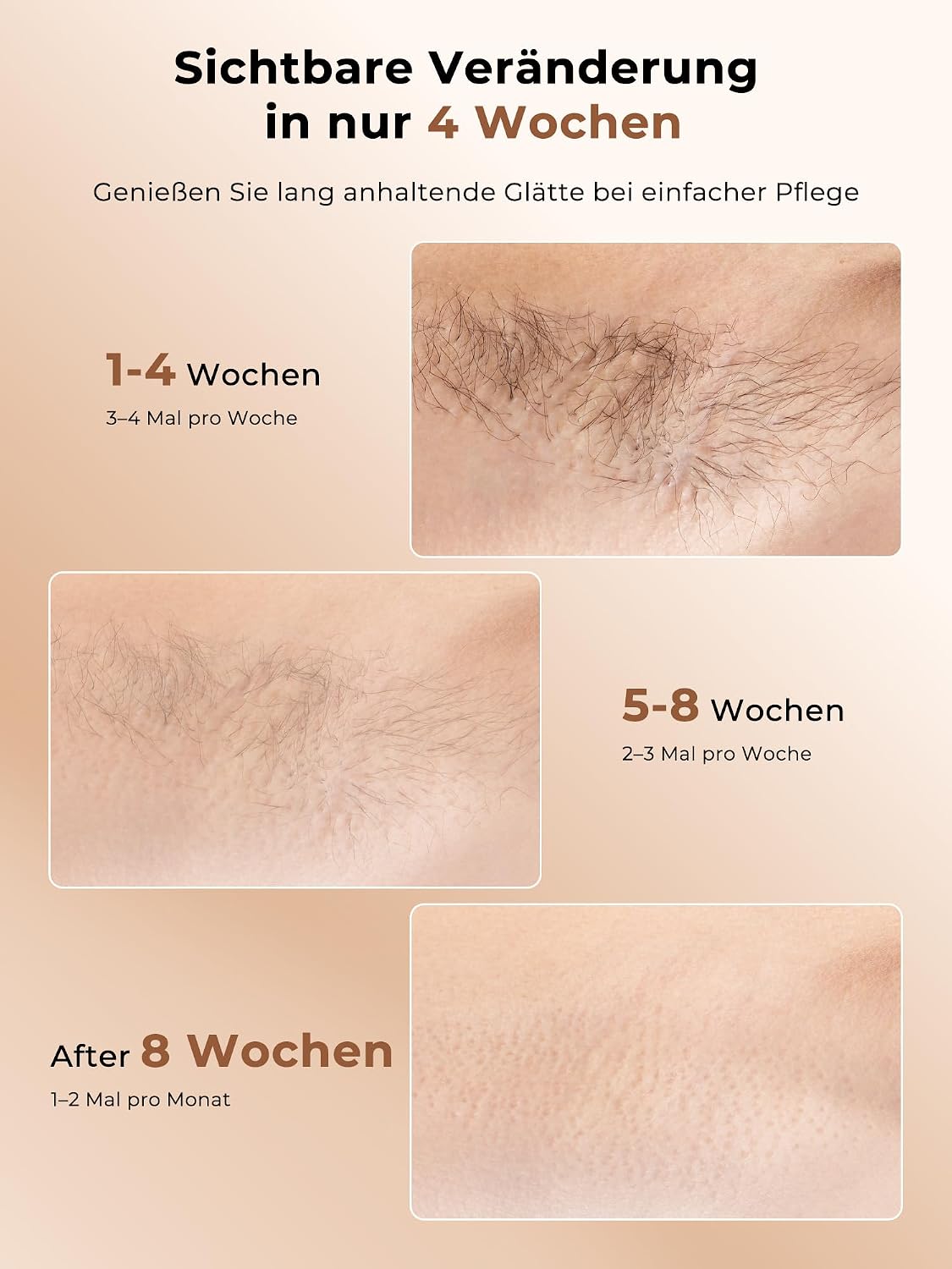 Detalle de IPL Gerät zur Haarentfernung mit Kühlfunktion – 9 Stufen, 600–1200 nm, 999.900 Blitze – Gesicht & Körper