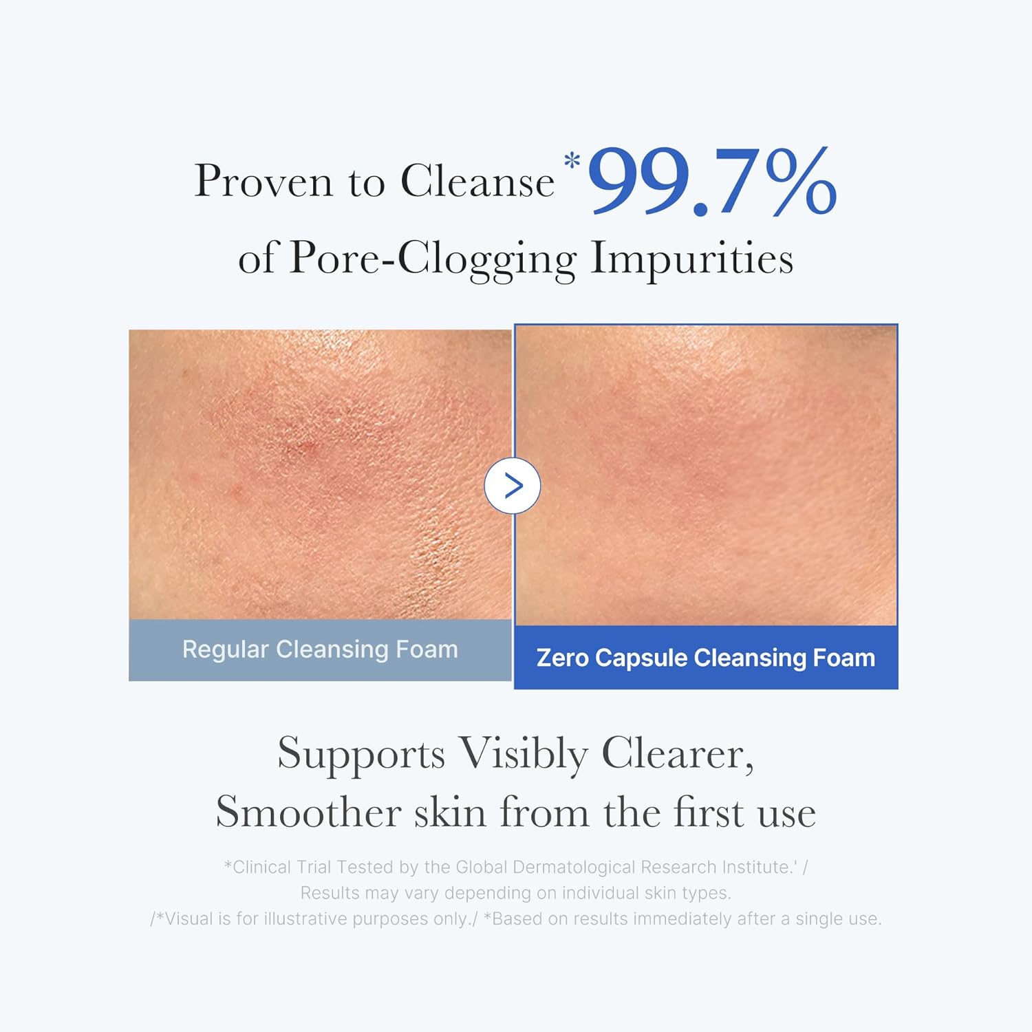 Detalle de Medicube Zero Pore Clear Blue Capsule Cleanser – Sanfter Schaumsreiniger mit AHA, BHA & PHA