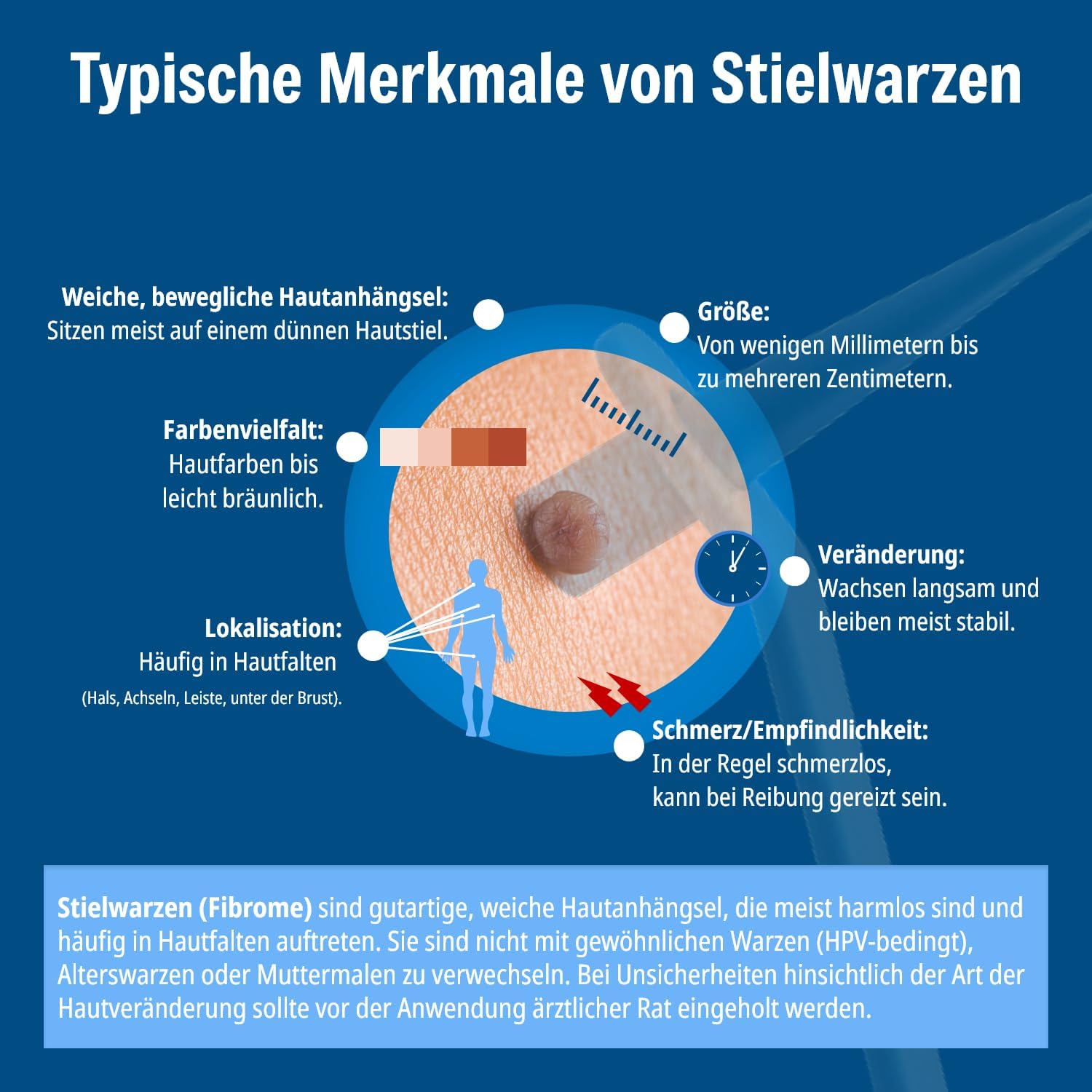 Thumbnail 6 de Evolsin Anti Stielwarzen Gel – natürliches Mittel gegen Stielwarzen