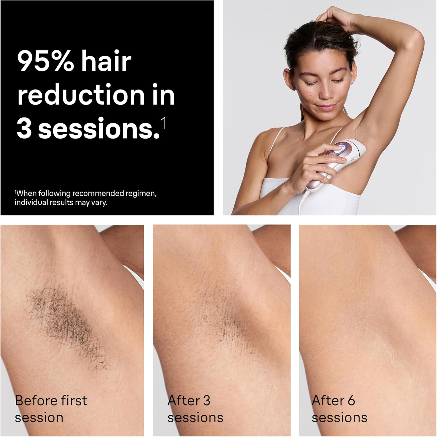 Thumbnail 4 de Braun Smart IPL Skin i·Expert 10 min