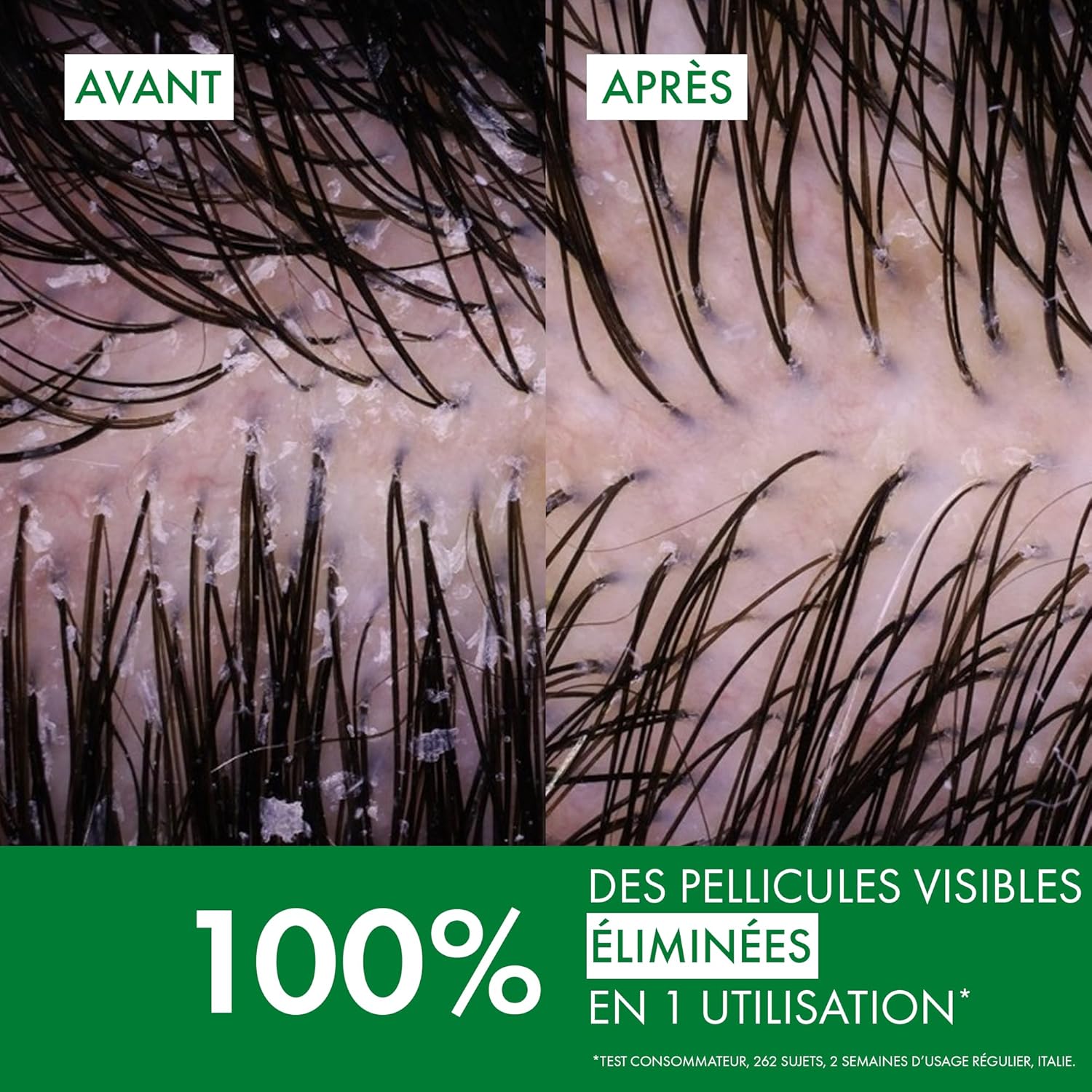 Detalle de Vichy Dercos Shampooing Anti-Pelliculaire DS – Pour cheveux secs, Pellicules et Démangeaisons