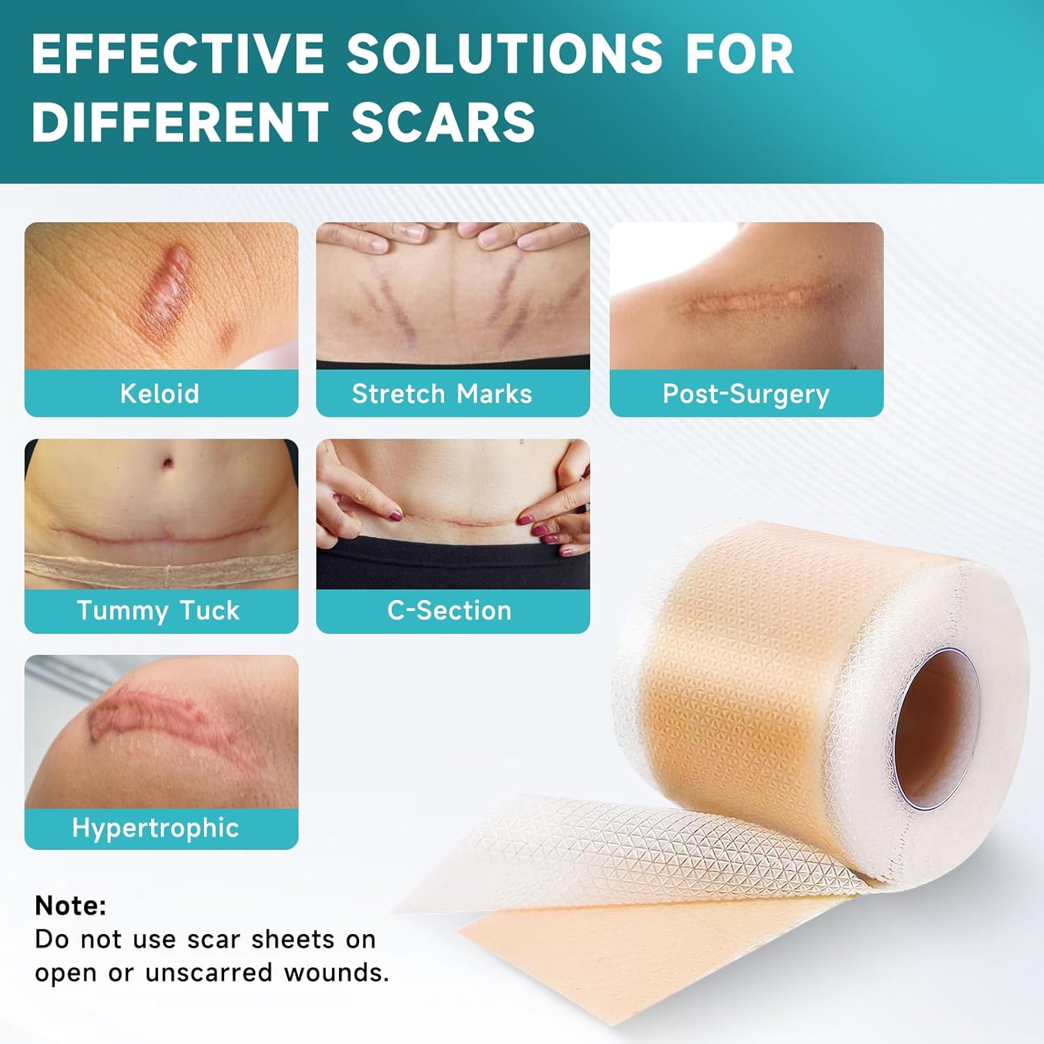 Detalle de Pumkot Silicone Scar Sheets: Medical-Grade Scar Tape for Surgical Scars, C-Sections, Burns