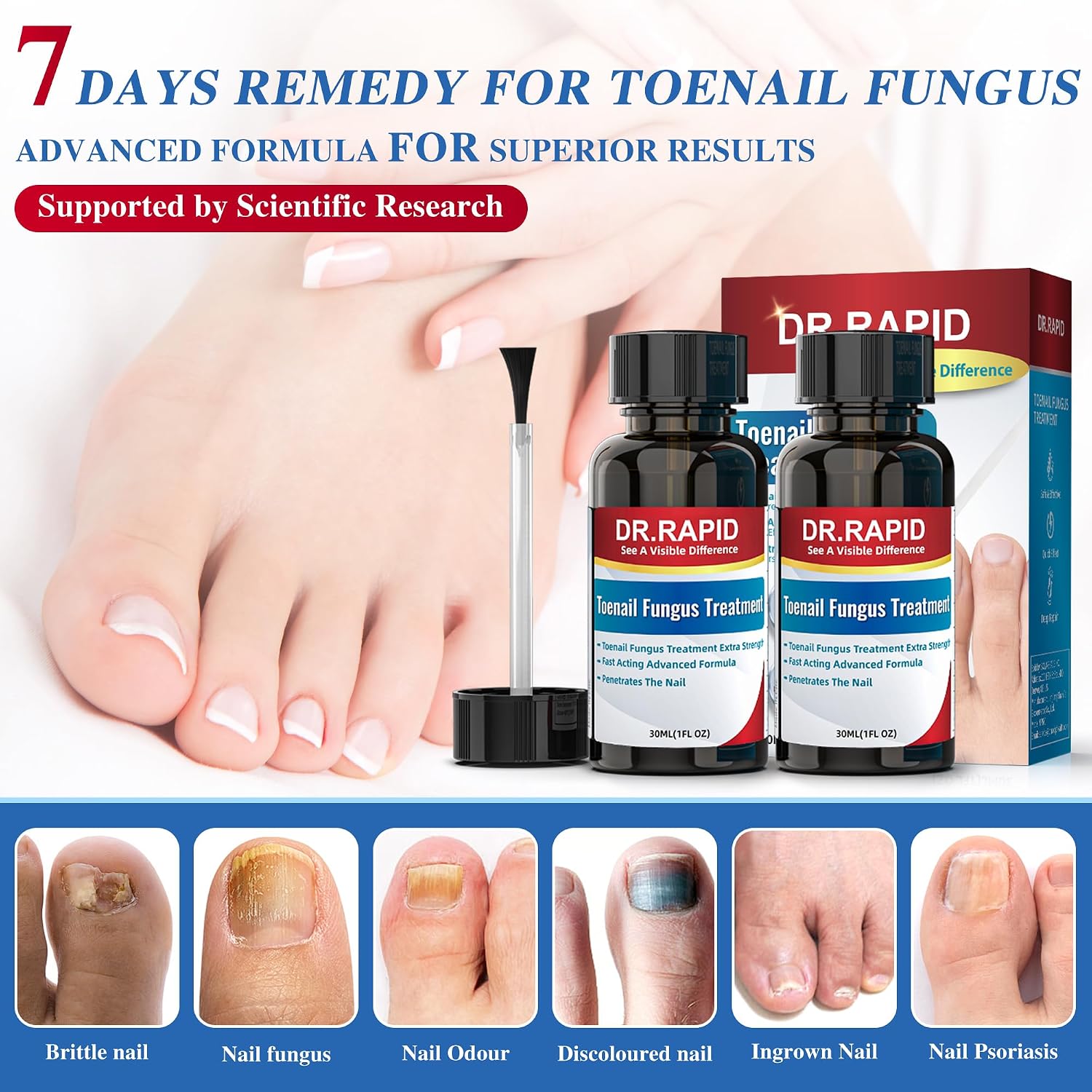 Detalle de Toenail Fungus Treatment with 25% Undecylenic Acid