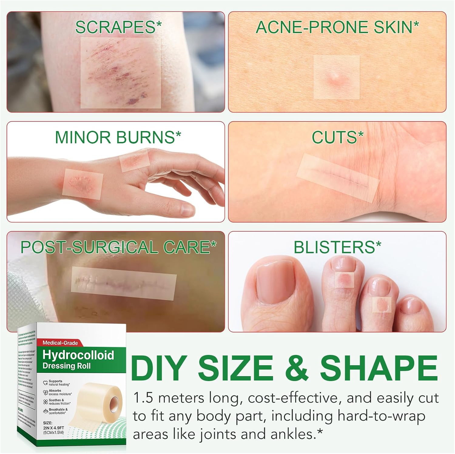 Thumbnail 5 de Alstaky Hydrocolloid Dressing Roll, 5CM x 1.5M, Absorbent and Breathable